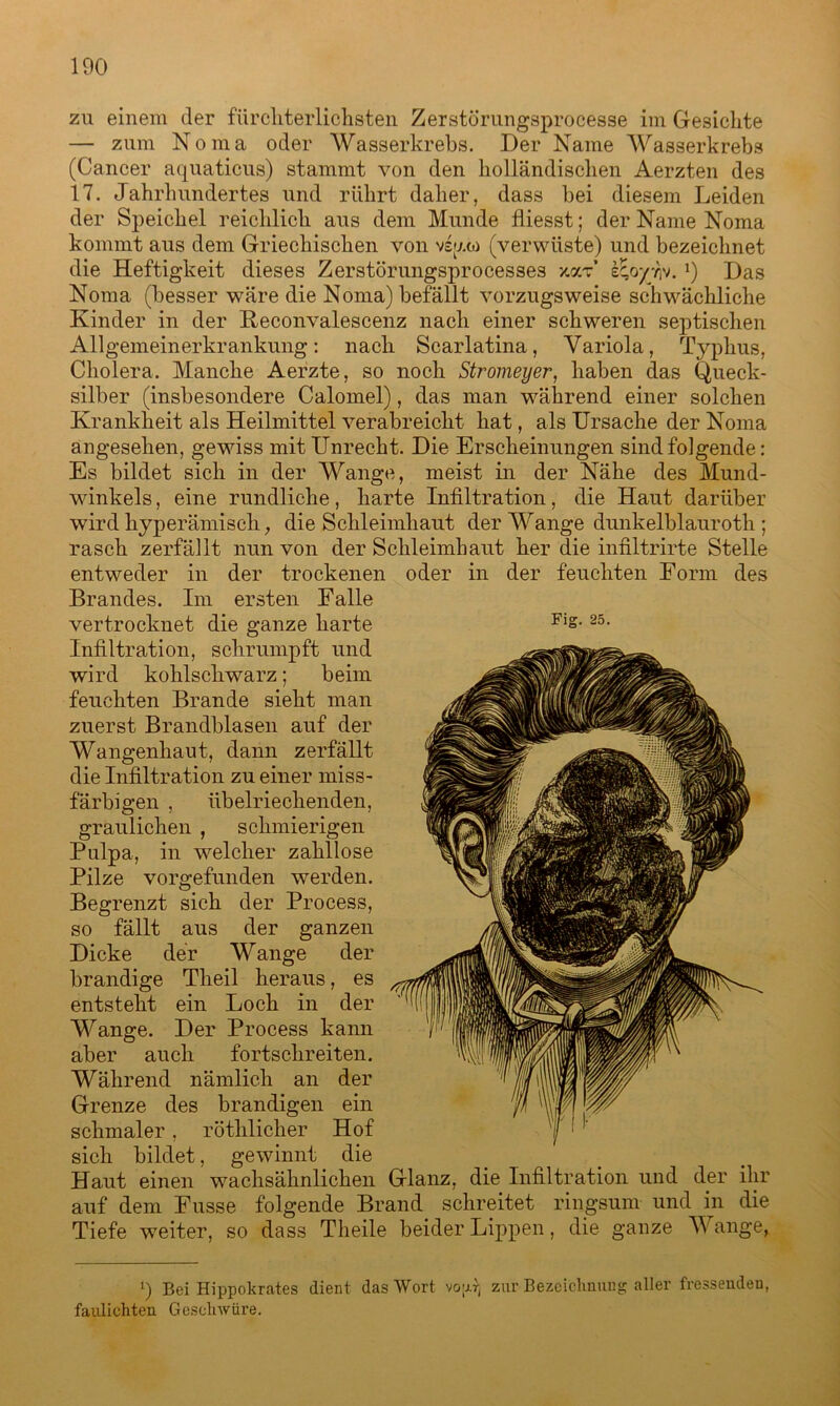 zu einem der fürchterlichsten Zerstörungsprocesse im Gesichte — zum Noma oder Wasserkrebs. Der Name Wasserkrebs (Cancer aquaticus) stammt von den holländischen Aerzten des 17. Jahrlnmdertes und rührt daher, dass bei diesem Leiden der Speichel reichlich aus dem Munde fliesst; der Name Noma kommt aus dem Griechischen von vsaw (verwüste) und bezeichnet die Heftigkeit dieses Zerstörungsprocesses xoct’ kP-oyry. i) Las Noma (besser wäre die Noma) befällt vorzugsweise schwächliche Kinder in der Keconvalescenz nach einer schweren septischen All gemein erkr ankung: nach Scarlatina, Variola, Typhus, Cholera. Manche Aerzte, so noch Stromeyer, haben das Queck- silber (insbesondere Calomel), das man während einer solchen Krankheit als Heilmittel verabreicht hat, als Ursache der Noma angesehen, gewiss mit Unrecht. Die Erscheinungen sind folgende: Es bildet sich in der Wange, meist in der Nähe des Mund- winkels , eine rundliche, harte Infiltration, die Haut darüber wird hyperämisch, die Schleimhaut der Wange dunkelblauroth ; rasch zerfällt nun von der Schleimhaut her die infiltrirte Stelle entweder in der trockenen oder in der feuchten Form des Brandes. Im ersten Falle vertrocknet die ganze harte Infiltration, schrumpft und wird kohlschwarz; beim feuchten Brande sieht man zuerst Brandblasen auf der Wangenhaut, dann zerfällt die Infiltration zu einer miss- färbigen , übelriechenden, graulichen , schmierigen Pulpa, in welcher zahllose Pilze vorgefunden werden. Begrenzt sich der Process, so fällt aus der ganzen Dicke der Wange der brandige Theil heraus, es entsteht ein Loch in der Wange. Der Process kann aber auch forts ehr eiten. Während nämlich an der Grenze des brandigen ein schmaler, röthlicher Hof sich bildet, gewinnt die Haut einen wachsähnlichen Glanz, die Infiltration und der ihr auf dem Fusse folgende Brand schreitet ringsum und in die Tiefe weiter, so dass Theile beider Lippen, die ganze Wange, l) Bei Hippokrates dient das Wort vo;j.7j zur Bezeichnung aller fressenden, faulichten Geschwüre.