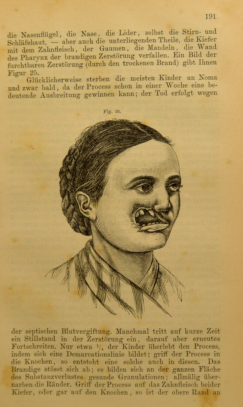 die Nasenflügel, die Nase, die Lider, selbst die Stirn- und Schläfehaut, — aber auch die unterliegenden Theile, die Nieter mit dem Zahnfleisch, der Gaumen, die Mandeln,. die Wand des Pharynx der brandigen Zerstörung verfallen. Ein Bild der furchtbaren Zerstörung (durch den trockenen Brand) gibt Ihnen Figur 25. . .. Glücklicherweise sterben die meisten Kinder an Noma und zwar bald, da der Process schon in einer Woche eine be- deutende Ausbreitung gewinnen kann; der Tod erfolgt wegen Fig. 2G. der septischen Blutvergiftung. Manchmal tritt auf kurze Zeit ein Stillstand in der Zerstörung ein, darauf aber erneutes Fortschreiten. Nur etwa 1/4 der Kinder überlebt den Process, indem sich eine Demarcationslinie bildet; griff der Process in die Knochen, so entsteht eine solche auch in diesen. Das Brandige stösst sich ab; es bilden sich an der ganzen Fläche des Substanzverlustes gesunde Granulationen; allmälig iiber- narben die Ränder. Griff der Process auf das Zahnfleisch beider Kiefer, oder gar auf den Knochen , so ist der obere Rand an