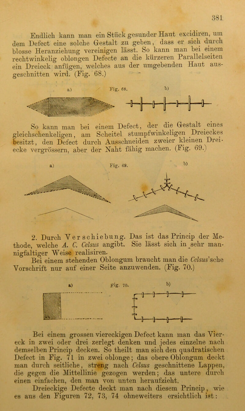 Endlich kann man ein Stück gesunder Haut excidiren, um dem Defect eine solche Gestalt zu geben, dass er sich durch blosse Heranziehung vereinigen lässt. So kann man bei einem rechtwinkelig oblongen Defecte an die kürzeren Parallelseiten ein Dreieck anfügen, welches aus der umgebenden Haut aus- geschnitten wird. (Fig. 68.) a) Fig. 68. b) HHhHHH1“ So kann man bei einem Defect, der die Gestalt . eines gleichschenkeligen, am Scheitel stumpfwinkeligen Dreieckes besitzt, den Defect durch Ausschneiden zweier kleinen Drei- ecke vergrössern, aber der Naht fähig machen. (Fig. 69.) a) Fig. 69. b) 2. Durch Verschiebung. Das ist das Princip der Me- thode, welche A. C. Celsus angibt. Sie lässt sich in sehr man- nigfaltiger Weise realisiren. Bei einem stehenden Oblongum braucht man die tato’sche Vorschrift nur auf einer Seite anzuwenden. (Fig. 70.) a) Fig- 70. b) §§§l f 1 I i i i i i i { i t i i jjgj t Bei einem grossen viereckigen Defect kann man das Vier- eck in zwei oder drei zerlegt denken und jedes einzelne nach demselben Princip decken. So theilt man sich den quadratischen Defect in Fig. 71 in zwei oblonge; das obere Oblongum deckt man durch seitliche, streng nach Celsus geschnittene Lappen, die gegen die Mittellinie gezogen werden; das untere durch einen einfachen, den man von unten heraufzieht. Dreieckige Defecte deckt man nach diesem Princip, wie es aus den Figuren 72, 73, 74 ohneweiters ersichtlich ist: