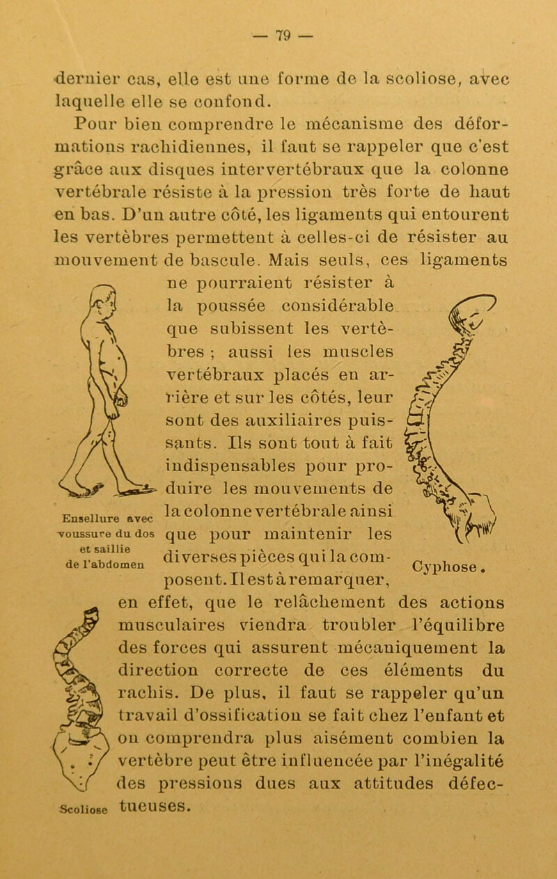 dernier cas, elle est une forme de la scoliose, avec laquelle elle se confond. Pour bien comprendre le mécanisme des défor- mations rachidiennes, il faut se rappeler que c'est grâce aux disques intervertébraux que la colonne vertébrale résiste à la pression très forte de haut en bas. D’un autre côté, les ligaments qui entourent les vertèbres permettent à celles-ci de résister au mouvement de bascule. Mais seuls, ces ligaments ne pourraient résister à la poussée considérable que subissent les vertè- bres ; aussi les muscles vertébraux placés en ar- rière et sur les côtés, leur sont des auxiliaires puis- 0| sants. Ils sont tout à fait indispensables jDonr pro- duire les mouvements de la colonne vertébrale ainsi que pour maintenir les diverses pièces qui la com- posent. Il est à remarquer, en effet, que le relâchement des actions musculaires vdendra troubler l’équilibre des forces qui assurent mécaniquement la direction correcte de ces éléments du rachis. De plus, il faut se rappeler qu’un travail d’ossification se fait chez l’enfant et on comprendra plus aisément combien la vertèbre peut être influencée par l’inégalité des pressions dues aux attitudes défec- Scoiiose tueuses. Ensellure avec voussure du dos et saillie de l'abdomen Cyphose.