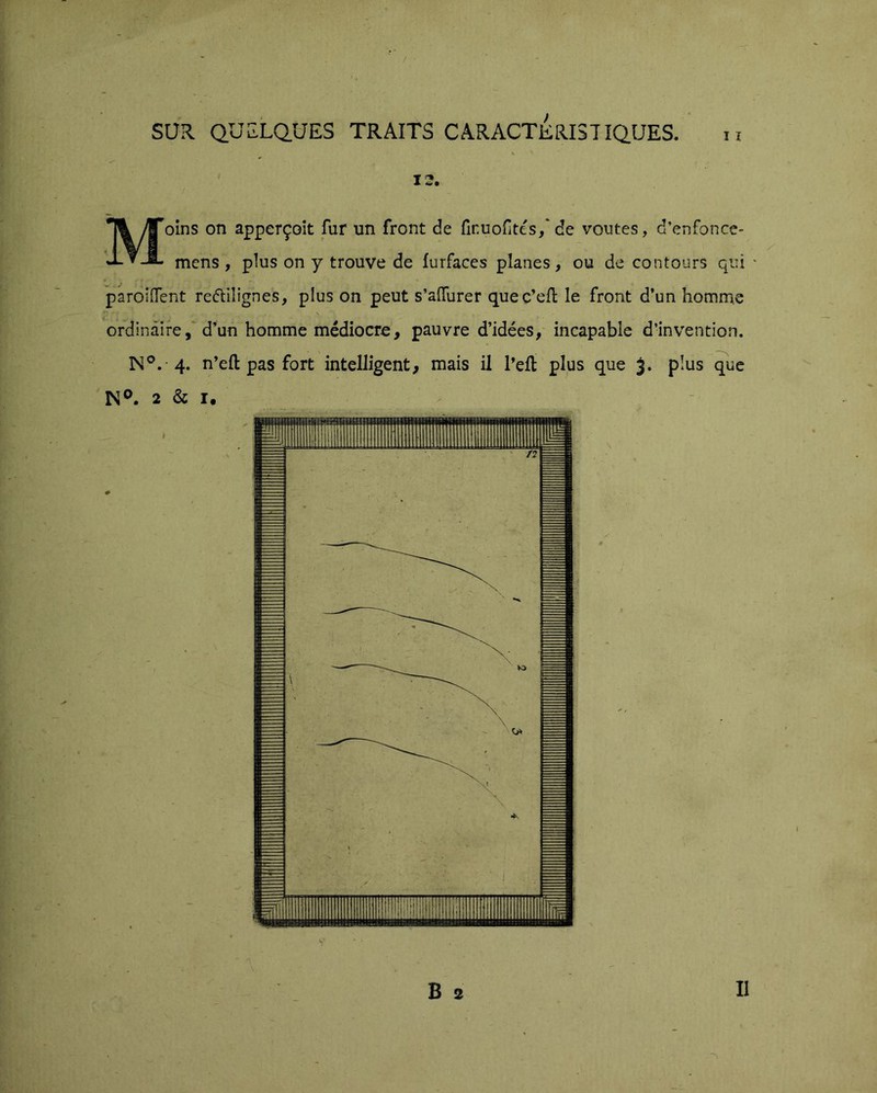 r SUR. QUELQUES TRAITS CARACTERISTIQUES. ii f T ^ X âi,0 Moins on apperçoît fur un front de fir.uoftés,'de voûtes, d’enfonce- mens , plus on y trouve de furfaces planes, ou de contours qui ' pardiffent re(5lilignes, plus on peut s’affurer quec’efl le front d’un homme ordinaire,'d’un homme médiocre, pauvre d’idées, incapable d’invention. N®. 4. n’eft pas fort intelligent, mais il l’eft plus que 3. plus que N®. 2 & I, i