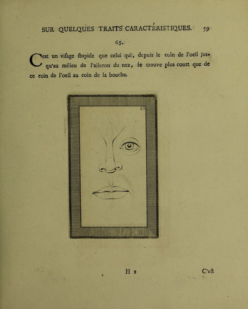 SUR QUELQUES TRAITS CARACTERISTIQUES. 59 65. ’ Cest un vifage ftupide que celui qui, depuis le coin de l’oeil jus* qu’au milieu de l’aileron du nez, le trouve plus court que de ce coin de l’oeil au coin de la bouche.