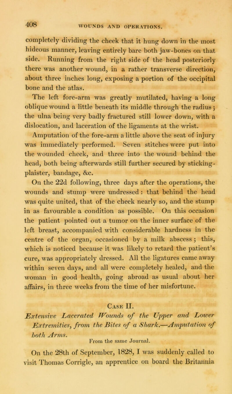 completely dividing the cheek that it hung down in the most hideous manner, leaving entirely bare both jaw-bones on that side. Running from the right side of the head posteriorly there was another wound, in a rather transverse direction, about three inches long, exposing a portion of the occipital bone and the atlas. The left fore-arm was greatly mutilated, having a long oblique wound a little beneath its middle through the radius ; the ulna being very badly fractured still lower down, with a dislocation, and laceration of the ligaments at the wrist. Amputation of the fore-arm a little above the seat of injury was immediately performed. Seven stitches were put into the wounded cheek, and three into the wound behind the head, both being afterwards still further secured by sticking- plaister, bandage, &c. On the 22d following, three days after the operations, the wounds and stump were undressed : that behind the head was quite united, that of the cheek nearly so, and the stump in as favourable a condition as possible. On this occasion the patient pointed out a tumor on the inner surface of the left breast, accompanied with considerable hardness in the centre of the organ, occasioned by a milk abscess ; this, which is noticed because it was likely to retard the patient’s cure, wTas appropriately dressed. All the ligatures came away within seven days, and all were completely healed, and the woman in good health, going abroad as usual about her affairs, in three weeks from the time of her misfortune. Case II. Extensive Lacerated Wounds of the Upper and Lower Extremities, from the Bites of a Shark.—Amputation of both Arms. From the same Journal. On the 28th of September, 1828, I was suddenly called to visit Thomas Corrigle, an apprentice on board the Britannia