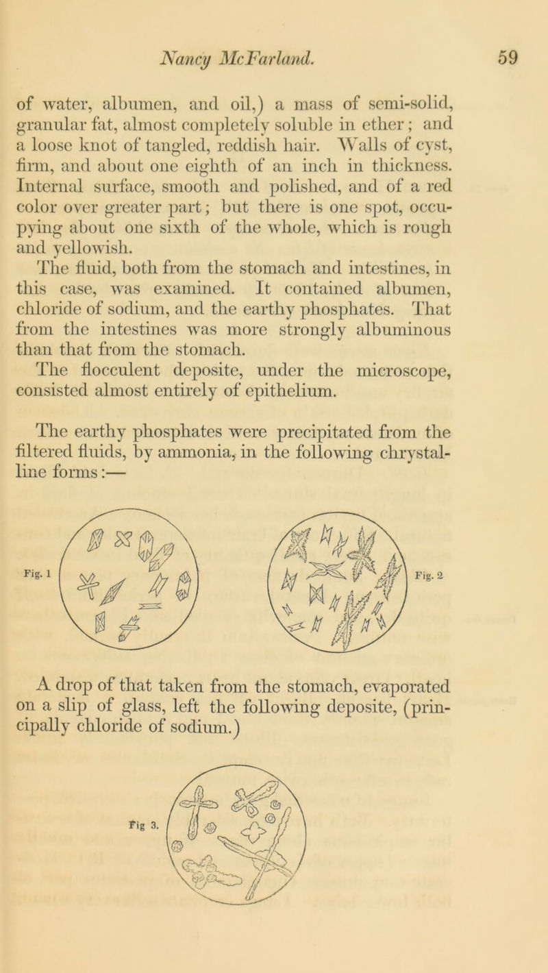 of water, albumen, and oil,) a mass of semi-solid, granular fat, almost completely soluble in ether; and a loose knot of tangled, reddish hair. Walls of cyst, firm, and about one eighth of an inch in thickness. Internal surface, smooth and polished, and of a red color over greater part; but there is one spot, occu- pying about one sixth of the whole, which is rough and yellowish. The fluid, both from the stomach and intestines, in this case, was examined. It contained albumen, chloride of sodium, and the earthy phosphates. That from the intestines was more strongly albuminous than that from the stomach. The flocculent deposite, under the microscope, consisted almost entirely of epithelium. The earthy phosphates were precipitated from the filtered fluids, by ammonia, in the following chrystal- line forms:— A drop of that taken from the stomach, evaporated on a slip of glass, left the following deposite, (prin- cipally chloride of sodium.)