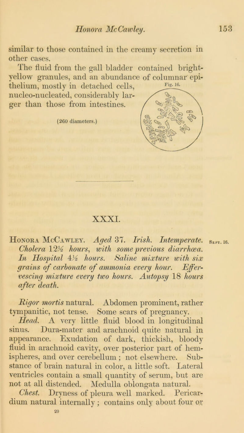 similar to those contained in the creamy secretion in other cases. The fluid from the gall bladder contained bright- yellow granules, and an abundance of columnar epi- thelium, mostly in detached cells, nucleo-nucleated, considerably lar- ger than those from intestines. (260 diameters.) XXXI. Honor a McCawley. Aged 37. Irish. Intemperate. Cholera V2lA hours, with some previous diarrhoea. In Hospital 4>2 hours. Saline mixture with six grains of carbonate o f ammonia every hour. Effer- vescing mixture every two hours. Autopsy 18 hours after death. Rigor mortis natural. Abdomen prominent, rather tympanitic, not tense. Some scars of pregnancy. Head. A very little fluid blood in longitudinal sinus. Dura-mater and arachnoid quite natural in appearance. Exudation of dark, thickish, bloody fluid in arachnoid cavity, over posterior part of hem- ispheres, and over cerebellum ; not elsewhere. Sub- stance of brain natural in color, a little soft. Lateral ventricles contain a small quantity of serum, but are not at all distended. Medulla oblongata natural. Chest. Dryness of pleura well marked. Pericar- dium natural internally ; contains only about four or 20 Fig. 16. Sept. 16.
