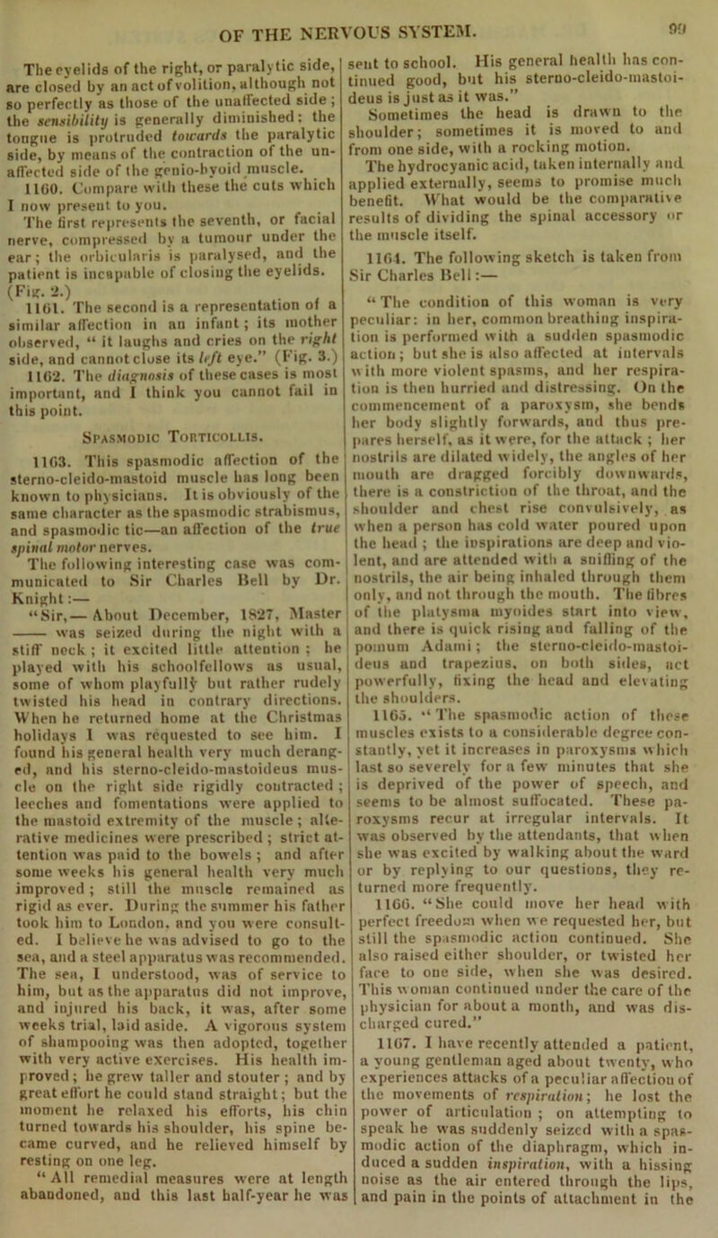 The eyelids of the right, or paralytic side, are closed by an act of volition, although not so perfectly as those of the unaffected side ; the sensibility is generally diminished: the tongue is protruded towards the paralytic side, by means of the contraction of the un- affected side of the genio-bvoid muscle. 1100. Compare with these the cuts which 1 now present to you. The first represents the seventh, or facial nerve, compressed by a tumour under the ear; the orbicularis is paralysed, and the patient is incapable of closing the eyelids. (Fig. 2.) . 1101. The second is a representation ot a similar affection in au infant; its mother observed, “ it laughs and cries on the right side, and cannot close its left eye.” (Fig. 3.) 1102. The diagnosis of these cases is most important, and I think you cannot fail in this point. Spasmodic Torticollis. 1103. This spasmodic affection of the sterno-cleido-mastoid muscle has long been known to physicians. It is obviously of the same character as the spasmodic strabismus, and spasmodic tic—an affection of the true spinal motor nerves. The following interesting case was com- municated to Sir Charles Hell by Dr. Knight:— “Sir,— About December, 1827, Master was seized during the night with a stiff neck ; it excited little attention ; he played with his schoolfellows as usual, some of whom playfully but rather rudely twisted his head in contrary directions. When he returned home at the Christmas holidays I was requested to see him. I found his general health very much derang- ed, and his sterno-cleido-mastoideus mus- cle on the right side rigidly contracted ; leeches and fomentations were applied to the mastoid extremity of the muscle; alte- rative medicines were prescribed; strict at- tention was paid to the bowels ; and after some weeks his general health very much improved; still the muscle remained as rigid as ever. During the summer his father took him to London, and you were consult- ed. 1 believe he was advised to go to the sea, and a steel apparatus was recommended. The sea, I understood, was of service to him, but as the apparatus did not improve, and injured his back, it was, after some weeks trial, laid aside. A vigorous system of shampooing was then adopted, together with very active exercises. His health im- proved ; he grew taller and stouter ; and by great effort he could stand straight; but the moment he relaxed his efforts, his chin turned towards his shoulder, his spine be- came curved, and he relieved himself by resting on one leg. “All remedial measures were at length abandoned, and this last half-year he was 00 sent to school. His general health has con- tinued good, but his sterno-cleido-masloi- deus is just as it was.” Sometimes the head is drawn to the shoulder; sometimes it is moved to and from one side, with a rocking motion. The hydrocyanic acid, taken internally and applied externally, seems to promise much benefit. What would be the comparative results of dividing the spinal accessory or the muscle itself. 1104. The following sketch is taken from Sir Charles llell:— “ The condition of this woman is very peculiar: in her, common breathing inspira- tion is performed with a sudden spasmodic action; but she is also affected at intervals with more violent spasms, and her respira- tion is then hurried and distressing. On the commencement of a paroxysm, she bends her body slightly forwards, and thus pre- pares herself, as it were, for the attack ; her nostrils are dilated widely, the angles of her mouth are dragged forcibly downwards, there is a constriction of the throat, and the shoulder and chest rise convulsively, as when a person has cold water poured upon the head ; the inspirations are deep and vio- lent, and are attended with a snifling of the nostrils, the air being inhaled through them only, and not through the mouth. The fibres of the platysma myoides start into view, and there is quick rising and falling of the pomum Adaini; the sterno-cleido-mastoi- deus and trapezius, on both sides, act powerfully, fixing the head and elevating the shoulders. 1165. “The spasmodic action of those muscles exists to a considerable degree con- stantly, yet it increases in paroxysms which last so severely for a few minutes that she is deprived of the power of speech, and seems to be almost suffocated. These pa- roxysms recur at irregular intervals. It was observed by the attendants, that when she was excited by walking about the ward or by replying to our questions, they re- turned more frequently. 1160. “She could move her head with perfect freedom when we requested her, but still the spasmodic action continued. She also raised either shoulder, or twisted her fare to one side, when she was desired. This woman continued under the care of the physician for about a month, and was dis- charged cured.” 1167. I have recently attended a patient, a young gentleman aged about twenty, who experiences attacks of a peculiar affection of the movements of respiration-, he lost the power of articulation ; on attempting to speak he was suddenly seized with a spas- modic action of the diaphragm, which in- duced a sudden inspiration, with a hissing noise as the air entered through the lips, and pain in the points of attachment in the