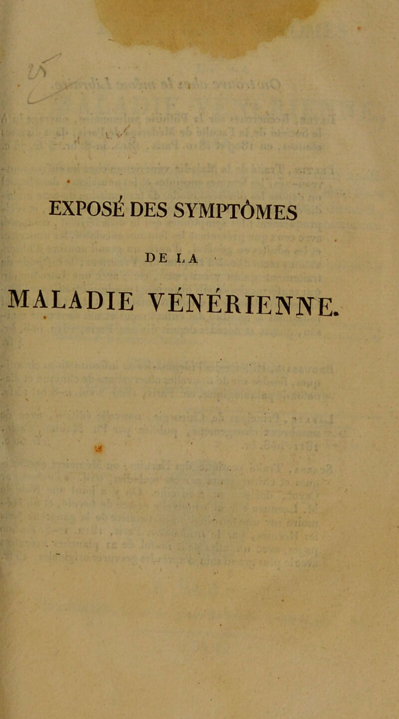 EXPOSÉ DES SYMPTÔMES D E L A MALADIE VÉNÉRIENNE.