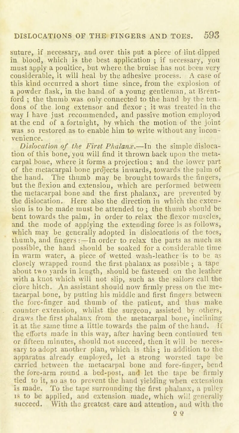suture, if necessary, and over this put a piece of lint dipped in blood, which is the best application ; if necessary, you must apply a poultice, but where the bruise has not been very considerable, it will heal by the adhesive process. A case of this kind occurred a short time since, from the explosion of a powder flask, in the hand of a youni; gentleman, at Brent- ford ; the thumb was only connected to the hand by the ten dons of the long extensor and flexor ; it was treated in the way I have just recommended, and passive motion eniployod at the end of a fortnight, by which the motion of the joint was so restored as to enable him to write without any incon- venience. Dislocation of the First Phalanx.—In the simple disloca- tion of this bone, you will find it thrown back upon the meta- carpal bone, where it forms a projection ; and the lower part of the metacarpal bone projects inwards, towards tlie ])alm of the hand. The thumb may be brought towards tlie fingers, but the flexion and extension, which are performed between the metacarpal bone and the first phalanx, are prevented by the dislocation. Here also the direction in which the exten- sion is to be made must be attended to ; the thumb should be bent towards the palm, in order to relax the flexor muscles, and the mode of applying the extending force is as follows, which may be generally adopted in dislocations of the toes, thumb, and fingers:—In order to relax the parts as much as possible, the hand should be soaked for a considerable time in warm water, a piece of wetted wash-leather is to be as closely wrapped round the first phalanx as possible ; a tape about two yards in length, should be fastened on the leather with a knot which will not slip, such as the sailors call the clove hitch. An assistant should now firmly press on the me- tacarpal bone, by putting his middle and first fingers between the fore-finger and thumb of the patient, and thus make counter extension, whilst the surgeon, assisted by others, draws the first phalanx from the metacarpal bone, inclining it at the same time a little towards the |)alm of the hand. If the efforts made in this way, after having been continued ten or fifteen minutes, should not succeed, then it will be neces- sary to adopt another plan, which is this ; in addition to the apparatus already employed, let a strong worsted tape be carried between the metacarpal bone and fore-finger, bend the fore-arm round a bed-post, and let the tape be firmly tied to it, so as to prevent the hand yielding wlien extension is made. To the tape surrounding the first i)halanx, a pulley IS to be applied, and extension made, which will generally succeed. With the greatest care and attention, and with tlie