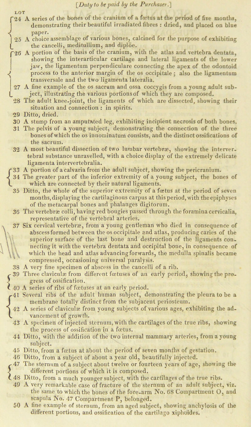 LOT '24 25 *26 27 *28 29 30 31 32 { 35 36 { A series of the bones of the cranium of a foetus at the period of five months, demonstrating their beautiful irradiated fibres : dried, and placed on blue paper. A choice assemblage of various bones, calcined for the purpose of exhibiting the cancelli, meditullium, and diploe. A portion of the basis of the cranium, with the atlas and vertebra dentata, showing the interarticular cartilage and lateral ligaments of the lower jaw, the ligamentum perpendiculare connecting the apex of the odontoid process to the anterior margin of the os occipitale; also the ligamentum transversale and the two ligamenta lateralia. A fine example of the os sacrum and ossa coccygis from a young adult sub- ject, illustrating the various portions of which they are composed. The adult knee-joint, the ligaments of which are dissected, showing their situation and connection : in spirits. Ditto, dried. A stump from an amputated leg, exhibiting incipient necrosis of both bones. The pelvis of a young subject, demonstrating the connection of the three bones of which the os inuominatum consists, and the distinct ossifications of the sacrum. A most beautiful dissection of two lumbar vertebrae, showing the interver- tebral substance unravelled, with a choice display of the extremely delicate ligamenta intervertebralia. A portion of a calvaria from the adult subject, showing the pericranium. 34 The greater part of the inferior extremity of a young subject, the bones of which are connected by their natural ligaments. Ditto, the whole of the superior extremity of a foetus at the period of seven months, displaying the cartilaginous carpus at this period, with the epiphyses of the metacarpal bones and phalanges digitorum. The vertebrae colli, having red bougies passed through the foramina cervicalia, representative of the vertebral arteries. Six cervical vertebrae, from a young gentleman who died in consequence of abscess formed between the os occipitale and atlas, producing caries of the superior surface of the last bone and destruction of the ligaments con- necting it with the vertebra dentata and occipital bone, in consequence of which the head and atlas advancingforwards, the medulla spinalis became compressed, occasioning universal paralysis. A very fine specimen of abscess in the cancelli of a rib. Three claviculas from different foetuses of an early period, showing the pro- gress of ossification. A. series of ribs of foetuses at an early period. Several ribs of the adult human subject, demonstrating the pleura to be a membrane totally distinct from the subjacent periosteum. A series of clavicular from young subjects of various ages, exhibiting the ad- vancement of growth. A specimen of injected sternum, with the cartilages of the true ribs, showing the process of ossification in a foetus. Ditto, with the addition of the two internal mammary arteries, from a young subject. Ditto, from a foetus at about the period of seven months of gestation. Ditto, from a subject of about a year old, beautifully injected. The sternum of a subject about twelve or fourteen years of age, showing the different portions of which it is composed. Ditto, from a much younger subject, with the cartilages of the true ribs. A very remarkable case of fracture of the sternum of an adult subject, viz. the same to which the bones of the fore-arm No. 6S Compartment O, and scapula No. 47 Compartment P, belonged. A fine example of sternum, from an aged subject, showing anchylosis of the different portions, and ossification of the cartilago xiphoides. 42 44 45 46 47 48 49 50