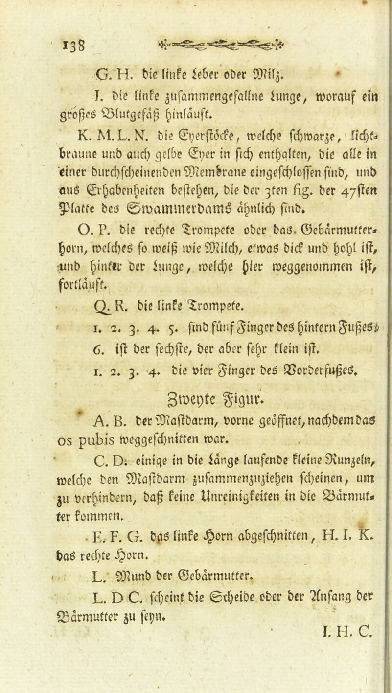 G. 11, bi'c f(nfe ie6ei* ob« I. bic linfe jufammengefaKne hinge, worauf ein grojjeö 55Iufgefn^ f;infauff. K. M.L. N. bie 0;erflocfe, n?cfcf)e fcfjmor^e, Udp braune unb and) gcfbe 0;er in fid? entgolten, bic ailc in 'einer biird)fd)einenbcn 3)^eni5»rQne eingefd}(offen finb, unb flu6 0‘5iQbcnf;eiten befielen, bie ber gfen fig. ber 47|Ien 5)iaffc be:3 0rüaminevl)aittö a^nlid) finb. O. P. bie red^fe ‘^rompefe ober batJ. ©ebnrmuffer* Ifiorn, tt>Gfd)eö fo wei^ mic9)ii(d;, efwaö bief unb ^ol;l. iff, -unb ^infir ber hinge, roeldje f^er meggenommen if?/ fordduff. Q:^R. bic iinfe‘JrompefG. I. 2. 3. 4. 5. finb fünf finger bcö ^infernSiip^^^ 6. ifi ber fed)|Ie, ber aber fef^r fiein ijT. I. 2. 3. 4» bie »ier ^iugev beö QSorberfu^eö, Smepte §iglU\ A. B. ber 5)iaflbarm, borne ged(fnefinad)bcmbaö os pubis weggefdjnirtcn roar. C. Di einige in bie idngc faufenbe Fietne S^vun^efn, weid)c ben 5)taftbarm jufammen^ujte^en fdjeinen, utn ju oerhinbern, ba^ feine Unreinigfeiten in bic 23drniuf« fer fommen. • E. F. G. bpö linfe Jporn abgefc^niden, H. I. K» baö red}te .^orn. L.' ‘JRunb ber ©cbdrmuder» L. D C. fdjeint bie 0d}eibe ober ber 7Cnfang bet S3drmu{fer ju fei;n* I. H. C.