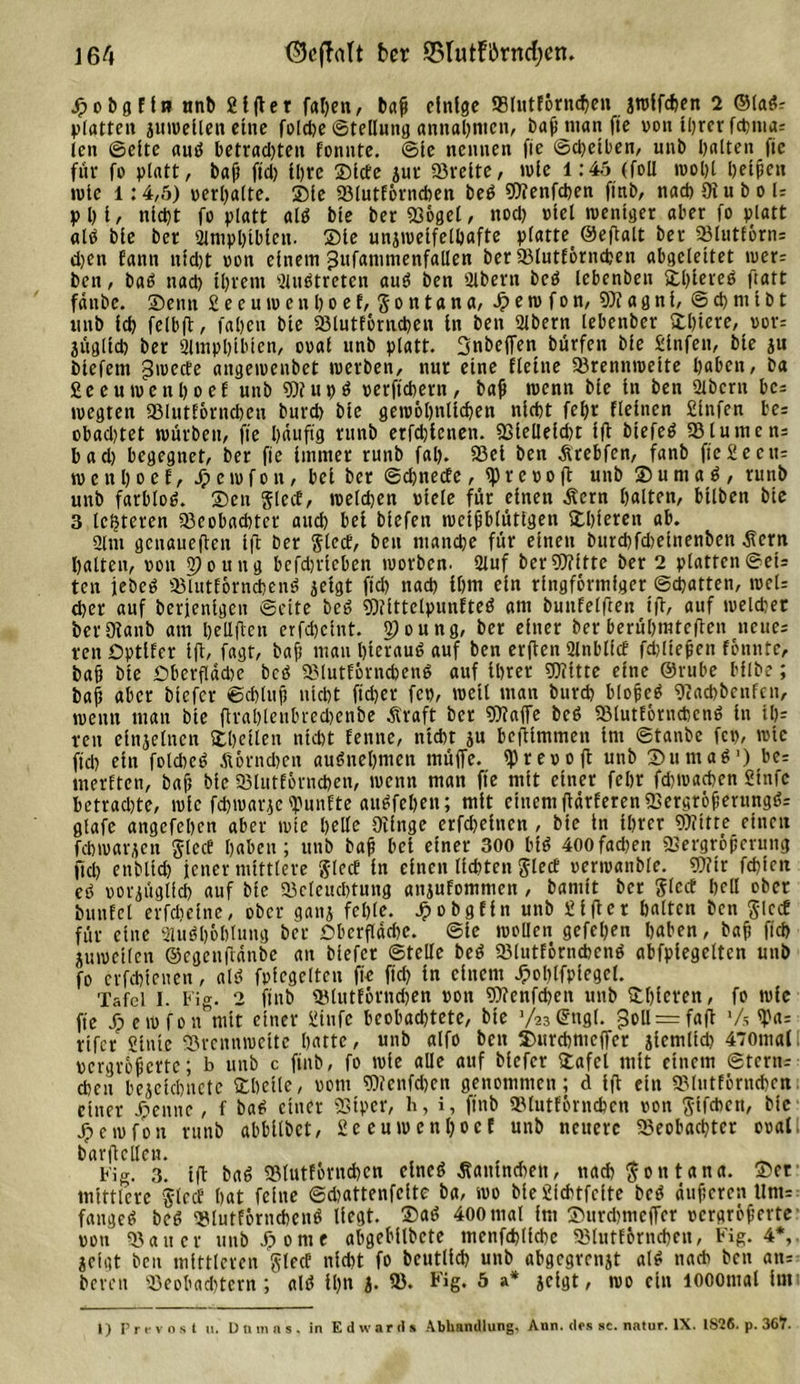 ]64 ©cjMt bcr ©lutförncfyen. Jpobgffn nnb giftet fal)en, baf einige Blutförncheu jralfdjen 2 ©lade platten zuweilen eine foldje ©tellung annahmen, baß man fie von ihrer fd)ina= len ©eite aud betrachten fonnte. ©le nennen fie ©djeiben, unb halten fie für fo platt, baß ftd) Ihre Side zur Ivette, wie 1:45 (foll wohl helfen wie l: 4,5) verhalte. Sie Blutförnchen bed Wenfchen fittb, nach 91 u b o U p 1) i / nicht fo platt ald btc her Böget, nod) viel weniger aber fo platt ald bie her 2lmpl)tbien. Sie unzweifelhafte platte^ ©eftalt her 93lutförn= d)en fann nid)t oon einem gufammenfallen her Blutlörncpen abgeleitet wer= hen, bad nad) ihrem 2ludtreten aud ben 2lhern bed lebenhen Stßieveö ftatt fänbe. Senn g e e u w e n h o e f, S o n t a n a, .ß e w f o n, W a g n i, ©cbmiht unh ich felbft, fahen hie Blutförnchen ln hen 2lhern lebenber fchtere, vor= jnglid) her Slmphtbten, ooal iinh platt. Snbeffen hürfen hie ginfen, hie zu hiefem j$wede angewenhet werben, nur eine fletne Brennweite haben, ha fieeuwenhoef unh Wu»d verftchern, baf wenn hie in hen 2thcrn bc* wegten Blutförnchen hurd) hie gewöhnlichen nicht fehr fleincn ginfen be= obadjtet würben, fie häufig runh erfd)icnen. Bielleid)t ift btefed 93 turne ns bad) begegnet, her fie immer runh fal). 93ei hen Ärebfen, fanh ftegecu= wenhoef, Jpewfon, bei her ©ebnede, ^)reooft unh Suntad, runh unh farblod. Sen gled, welchen viele für einen jtern halten, bilhen hie 3 leiteten 93eobachter aud) bei biefen weifblüttgen Shierett ab. Ülnt genaueren ift her Sied, heu manche für einen hurd)fd)einenhcn .Sern halten, von 2)ouug bcfd)rieben worben. 2luf her Witte her 2 platten ®ei= ten jebed Blutförncfend zeigt fid) nach ihm ein ringförmiger ©chatten, roeU d)er auf herfentgen ©eite hed Wittelpunfted am hunfelften ift, auf weldjet her Oianb am hcllften erfdjeint. 2)oung, her einer her berühmteren neue; ren Dptifer ift/ fagt, baß mau hievaud auf ben erften 2lnbltd fdjlief en fonnte, haß hie Dberfläcbe bed 93lutförnchcnd auf ihrer Witte eine ©rube bilhe; haß aber hiefer ©chtuf nicht fid)er fev, weit man hurd) bloßed 9}ad)bcufcn, wenn man hie ftval)leubred)cnbe Äraft her Waffe hed 93lutförnchcnd in th= ren einzelnen Shciten nicht fenne, nicht ju beftimmen im ©tanbe fev, wie fid) ein fold)cd Äörndjen audnehmen müffe. fprevoft unh Sumad1) be= inerften, haß hie 93lutförnd)en, wenn man fie mit einer fehr fd)wachen ginfe betrad)te, wie fdjwarze fünfte audfeben; mit einem ftärferen 93ergröferungd= gtafc angefehen aber wie helle Oifnge erfüllten , hie in ihrer Witte einen fehwarjen Sied haben; unh haß bei einer 300 bid 400fad)en Bergröferung fiel) enhltd) jener mittlere glecf in einen lichten Sied verwandle. Wir fehlen ed vorzüglich auf hie 93c(euchtung anjufommen , hamit her Jlcd hell ober hunfcl crfcheinc, ober ganz fehle. Jpobgfin unh g ift er halten hen glcd für eine ffludhöhlung her £&gt;berfläd)C. ©ie wollen gefehen haben, haß fid) Zuweilen ©cgcnftänhe an hiefer ©teile hed 93lutförncbcnd abfpiegclten unh fo crfchienen, ald fvicgeltcn fie fiel) in einem .ßohlfplegcl. Tafel 1. big. 2 ftnb Blutförndjen von Wenfd)en unh Shicren, fo wie fie jp e w f o n mit einer ginfe bcobad)tete, hie ’/asSngl. 5oll = faft Vs ^ rifer ginte Brennweite hatte, unb alfo hen Surchmcffer ziemlid) 470mal vergröferte; b unb c ftnb, fo wie alle auf hiefer Safct mit einem ©tern-- chcu bezeichnctc Shctle, vom Wcnfd)cn genommen; d ift ein 93lutförnchen einer jpennc, f bad einer Biper, h, i, ftnb Blutförnchen von J-ifcben, hie jpewfon runh abbilbet, geeuwenl)oef unh neuere Beobachter oval. harftcllen. , , , _ big. 3. ift had 93lutförnchcn eined ßautndwn, nach Montana. Ser mittlere 'Jled hat feine ©djattenfeite ha, wo hiegichtfcite hed äußeren tlm= fanged hed Blutförnchend liegt. Sad 400 mal im Surd)mcfTer vergröferte von Bauer unbJßome abgebilhete tncnfchliche Blutförnchen, b'ig. 4*,. Zeigt ben mittleren Sied nicht fo heutlid) unb abgegrenzt ald nach hen an= bereu Beobachtern; ald tl)n Z- 33- Fig- 5 a* icigt, wo ein looomal im