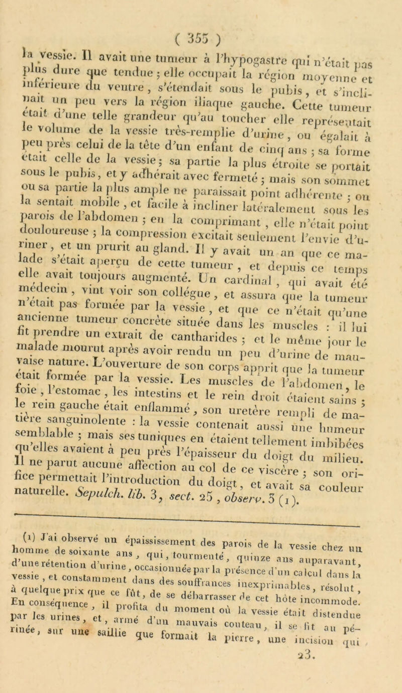 ( 353 ) .ve®sle- H avait mie tumeur à l’hypogastre qui n’était nas plus dure que tendue ; elle occupait la région moyenne et inferieure du ventre, s’étendait sous le pubis, et s’ineli iia.t un peu vers la région iliaque gauche. Cette tumeur , .“ une ;clle grandeur qu’au toucher elle représentait e volume de la vessie très-remplie d’urine, ou égalait à peu près celui de la tete d’un enfant de cinq ans ; sa forme ‘ t celle de la vessie ; sa partie la plus étroite se portait SOUS le pubis et y adhérait avec fermeté ; mais son sommet ou sa pattie la plus ample ne paraissait point adhérente • ou la sentait mobile , et facile à incliner latéralement sous'les w ois de abdomen ; en la comprimant , elle n’était point U uuieuse ; la compression excitait Seulement l’envie d’u- 1 de1';’', P™1 T gland’ 11 7 «vau un an que ce ma- lade s était aperçu de cette tumeur , et depuis ce temps elle avait tou,ours augmenté. Un cardinal , qui avait été mçdecni, vint voir son collègue, et assura q.ie la tumeur liait pas formée par la vessie, et que ce n’était qu’une ancienne tumeur concrète située dans les muscles • il lui prendre un extrait de cantharides ; et le même jour le malade mourut apres avoir rendu un peu d’urine de mau- étah forcée n “T dcTS° COrPS al’.nrit 'Iu<- la tumeur tait loi me e par la vessie. Les muscles de l’abdomen le loie ,1 estomac les intestins et le rein droit étaient sains • e rem gauche était enflammé, son uretère re.nnli de ma- tiere sanguinolente : la vessie contenait aussi une humeur semUalilc ; mais ses tuniques en étaient tellement imbibées .. elles avaient a peu près l’épaisseur du doigt du milieu f nt lwu al,c'Jne adection au col de ce viscère • son ori’ fîce permettait l’introduction du doûrt et pvnit ? , naturelle. Sepulch. lib. 3, 25 , oW.3 (T) C°U'eUI' (■) J ai observe un épaississement des parois de la vessie chez ,m homme de soixante ans, qui, tourmenté , quinze an auparavan d une rétention d’urine, occasionnée par la prLnce d’„„ . q,' vessie et constamment dans des souffrances inexpriù,àble8 i„h , En coi. éq ence , 'del'arrasser héte incommode. par le, u’neT et u ” d ' m°mem la ™i« était distendue * l» arme d un mauvais couteau il se lit o, nnee, sur une saillie mie formnit i • ' au Te~ que tonnait la pierre, une incision qui a3.