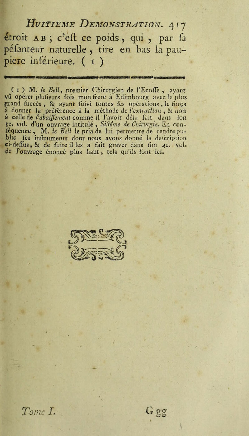 étroit qui , par fa péfanteur naturelle , tire en bas la pau¬ pière inférieure. ( i ) ( I ) Ri, le Bell, premier Chirurgien de l’Ecoflè , ayant vû opérer plufieurs fois monfrere à Edimbourg avec le plus grand fuccès , & ayant fuivi toutes fes opérations, le força à donner la préférence à la méthode de l’extraclion , ik non à celle de comme il l’avoir déjà fait dans ion je. vol. d’un ouvrage intitulé , Sifléme de Chirurgie. En cen- féquence , M. le Bell le pria de lui permettre de rendre pu¬ blic fes inftruments dont nous avons donné la deicripcion ci-defTus, 8c de fuite il les a fait graver dans ion 4e. vol. de l’ouvrage énoncé plus haut, tels qu’ils font ici.