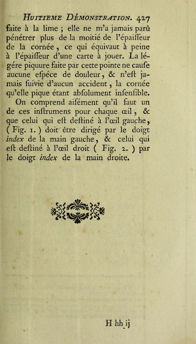 faite à la lime ; elle ne m’a jamais paru pénétrer plus de la moitié de l’épailTeur de la cornée ^ ce qui équivaut à peine à l’épailTeur d’une carte à jouer, La lé¬ gère piquure faite par cette pointe ne caufe aucune, elpéce de douleur, & n’eft ja¬ mais fuivie d’aucun accident, la cornée qu’elle pique étant abfolument infenfible. On comprend aifément qu’il faut un de ces inftrumens pour chaque œil, àc que celui qui eft deftiné à l’œil gauche, (Fig. I. ) doit être dirigé par le doigt index de la main gauche, & celui qui eft delHné à l’œil droit ( Fig. 2. ) par le doigt index de la main droite. H hh îj