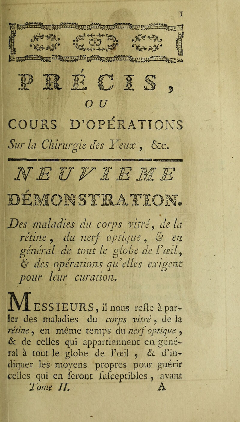 ï fc£ SSSi^^SSçK'^^^SSSÏ'^SÎ^SS^^^çzsSpS^^tK;^ r in i£i 9 C ï s O U COURS D’OPÉRATIONS Sur la Chirurgie des Yeux , &c. ~WU VIE Jf~ DÉMOM STS ATIOM» Des maladies du corps vitré, de la & eu rétine , du nerf optique général de tout le ^lohe de UœiC & des opérations qii elles exigent pour leur curation. M ESSIEURSj il nous refte ùpar¬ ler des maladies du corps vitré, de la rétine, en même temps du nerf optique , ôc de celles qui appartiennent en géné¬ ral à tout le globe de rœil , &. d’in¬ diquer les moyens propres pour guérir celles qui en feront fufceptibles , avant Tome IL A