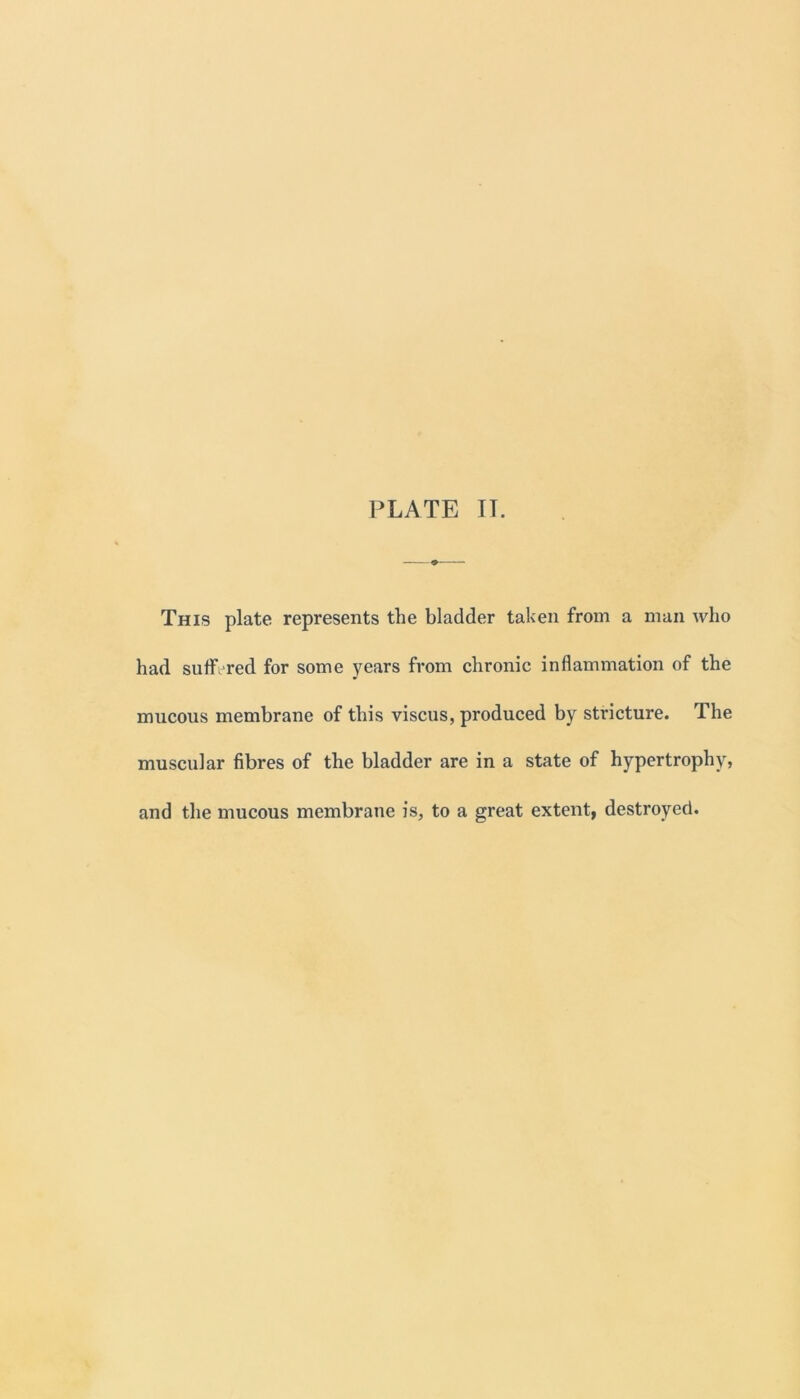 This plate represents the bladder taken from a man who had suffered for some years from chronic inflammation of the mucous membrane of this viscus, produced by stricture. The muscular fibres of the bladder are in a state of hypertrophy, and the mucous membrane is, to a great extent, destroyed.