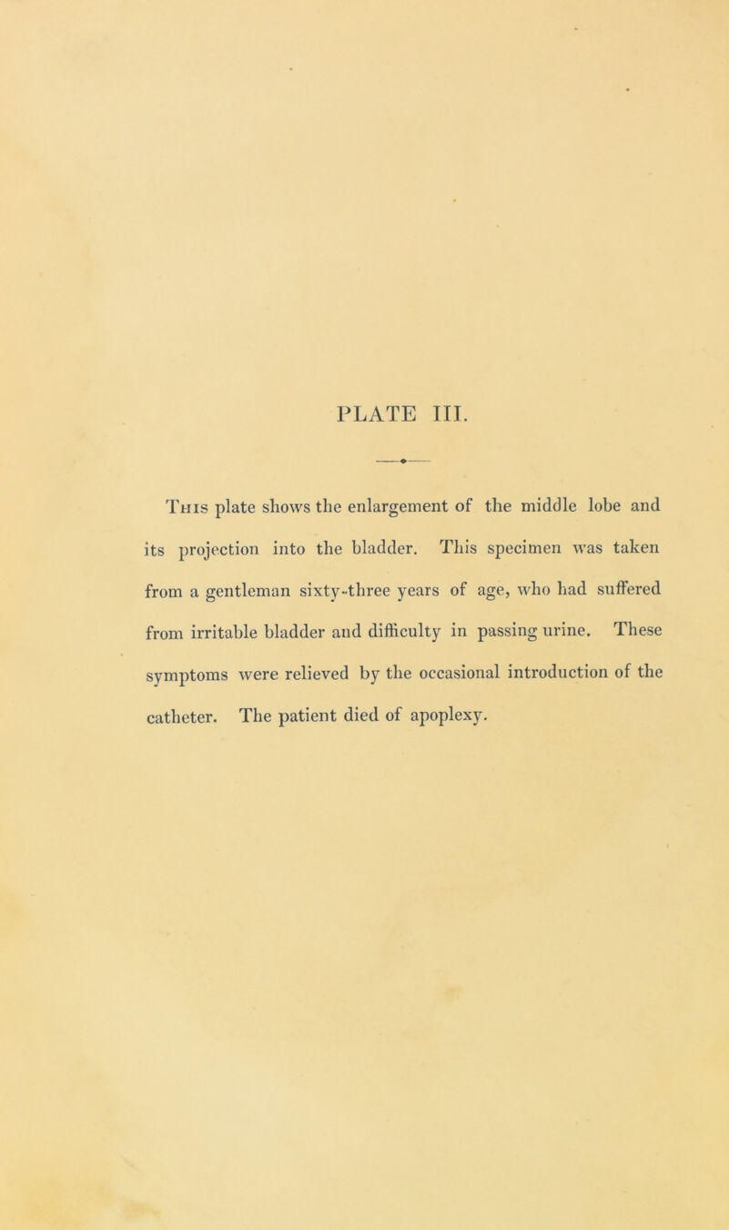 This plate shows the enlargement of the middle lobe and its projection into the bladder. This specimen was taken from a gentleman sixty-three years of age, who had suffered from irritable bladder and difficulty in passing urine. These symptoms were relieved by the occasional introduction of the catheter. The patient died of apoplexy.