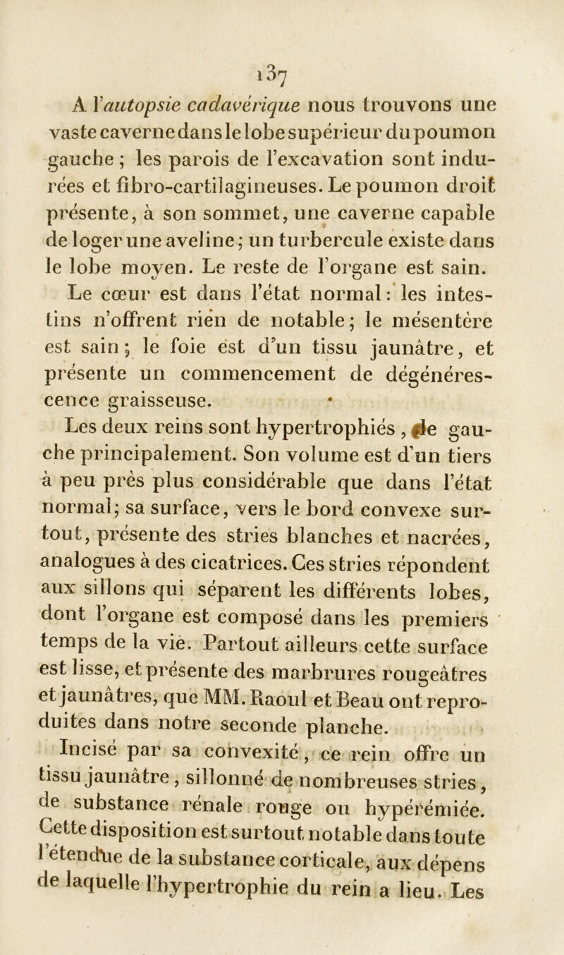 à Xautopsie cadavérique nous trouvons une vaste caverne dans le lobe supérieur du poumon gauche ; les parois de l’excavation sont indu- rées et fîbro-cartilagineuses. Le poumon droit présente, à son sommet, une caverne capable de loger une aveline; un turbercule existe dans le lobe moyen. Le reste de l’organe est sain. Le cœur est dans l’état normal : les intes- tins n’offrent rién de notable; le mésentère est sain; le foie est d’un tissu jaunâtre, et présente un commencement de dégénéres- cence graisseuse. Les deux reins sont hypertrophiés , |ie gau- che principalement. Son volume est d’un tiers à peu près plus considérable que dans l’état normal; sa surface, vers le bord convexe sur- tout, présente des stries blanches et nacrées, analogues à des cicatrices. Ces stries répondent aux sillons qui séparent les différents lobes, dont 1 organe est composé dans les premiers temps de la vie. Partout ailleurs cette surface est lisse, et présente des marbrures rougeâtres et jaunâtres, que MM. Raoul et Beau ont repro- duites dans notre seconde planche. Incisé par sa convexité, ce rein offre un tissu jaunâtre, sillonné de nombreuses stries, de substance renale rouge ou hypérémiée. Cette disposition est surtout notable dans toute letendlie de la substance corticale, aux dépens de laquelle l’hypertrophie du rein a lieu. Les