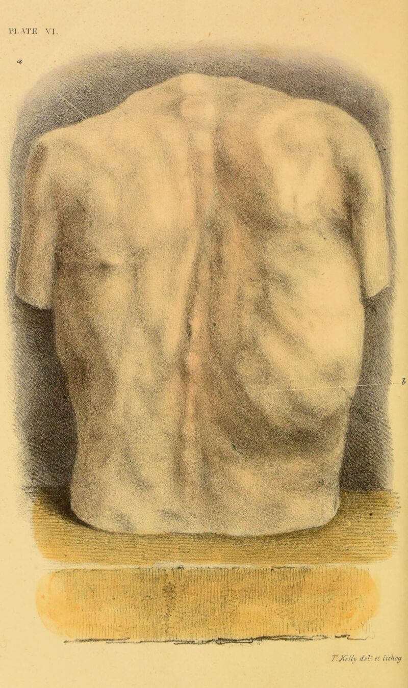 T.Jii lU deV. et hthcg.