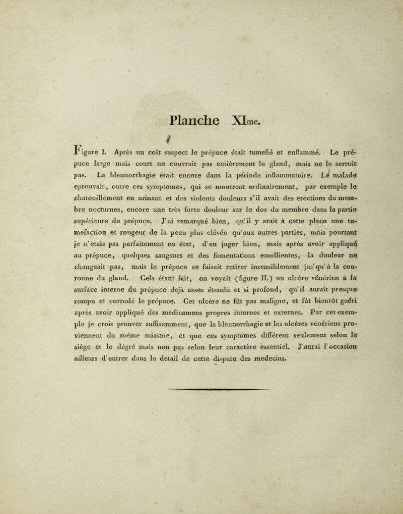 t Figure I. Apres un coi't suspect le prepuce etait tumeJfie et enflamme. Le pre- puce large mais court ne couvrait pas enticement le gland, mais ne le serroit pas. La blennorrhagie etait encore dans la periode inflammatoire. Li malade eprouvait, outre ces symptomes, qui se niontrent ordinairement, par exemple le chatouillement en urinant et des violents douleurs s'il avait des erections du mem- bre nocturnes, encore une tres forte douleur sur le dos du membre dans la partie superieure du prepuce. J’ai remarque bien, qu’il y arait a cette place une tu- mefaction et rougeur de la peau plus elevee qu’aux autres parties, mais pourtant je n’etais pas parfaitement en etat, d’en juger bien, mais apr^s avoir applique au prepuce, quelques sangsucs et des fomentations emollientes, la douleur ne changeait pas, mais le prepuce se faisait retirer insensiblement jus’qu’ala cou- ronne du gland. Cela etant fait, on voyait (figure II.) un ulcCe v&ierien a la surface interne du prepuce deja assez etendu et si profond, qu’il aurait presque rompu et corrode le prepuce. Cet ulcere ne fut pas maligne, et fut bient6t guCi apr£s avoir applique des medicamens propres internes et externes. Par cet exem- ple je crois prouver suifisamment, que la blennorrhagie et les ulcCes venCiens pro- viennent du m^ine miasme, et que ces symptomes different seulement selon le si&ge et le degre mais non pas selon leur caractere essentiel. J’aurai f occasion ailleurs d’entrer dans le detail de cette dispute des medecins.