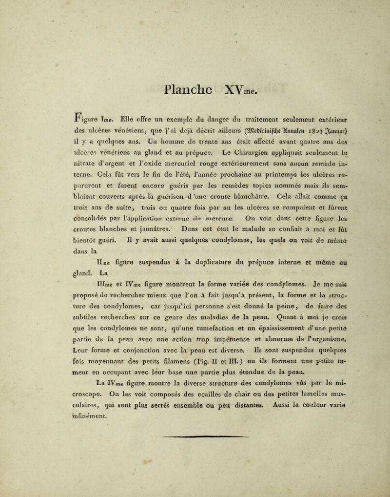 Figure Ime. Elle ofl’re un exemple du danger du traitement seulement exruiieur des ulceres veneriens, que j’ai deja decrit ailleurs (9)?e&icinifd)c TtnnaU’n 1803 %mm\) il y a quelques ans. Un homme de ti'ente ans etait affect^ avant quatre ans des ulceres veneriens au gland et au prepuce. Le Chirurgien appliquait seulement le nitrate d’argent et 1’oxide mercuriel rouge ext^rieurement sans aucun remede in- terne. Cela fut vers le fin de Fete, l’ann4e prochaine au printemps les ulceres re- parurent et furent encore gueris par les rem^des topics nommes mais ils sem- blaient couverts apr6s la guerison d ’une croute blanchatre. Cela allait comme ca trois ans de suite, trois ou quatre fois par an les ulceres se rompaient et furent consolides par l’application externe dn mercure. On voit dans cette figure les croutes blanches et jaunatres. Dans cet etat le malade se confiait a moi et fut bientdt gueri. Il y avait aussi quelques condylomes, les quels 011 voit de mdrae dans la line figure suspendus a la duplicature du prepuce interne et m£me au gland. La Illme et IVme figure montrent la forme variee des condylomes. Je me suis propose de rechercher mieux que l’on a fait jusqu’a present, la forme et la struc- ture des condylomes, car jusqu’ici personne s’est donne la peine, de faire des subtiles recherches sur ce genre des maladies de la peau. Quant a moi je crois que les condylomes ne sont, qu’une tumefaction et un epaississement d’une petite partie de la peau avec une action trop impetueuse et abnorme de l’organisme. Leur forme et conjonction avec la peau est diverse. Ils sont suspendus quelques fois moyennant des petits filamens (Fig. II et III.) ou ils forment une petite tu- meur en occupant avec leur base une partie plus ^tendue de la peau. La IV me figure montre la diverse structure des condylomes vus par le mi- croscope. On les voit composes des ecailles de chair ou des petites lamelles mus- culaires, qui sont plus series ensemble ou pen distantes. Aussi la couleur varia infin^ment.