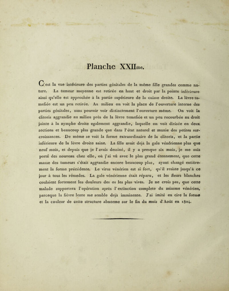 C est la vue int^rieure des parties genitales de la mfime fdle grandes comme na- ture. La tumeur moyenne est retiree en haut et droit par la pointe inferieure ainsi qu'elle est approchee a la partie superieure de la cuisse droite. La I6vre tu- mefiee est un peu retiree. Au milieu on voit la place de l’ouverture interne des parties genitales, sans pouvoir voir distinctement 1’ ouverture meme. On voit la clitoris aggrandie au milieu ptAs de la 16vre tumeliee et un peu recourbee au droit jointe a la nymphe droite egalement aggrandie, laquelle on voit divisee en deux sections et beaucoup plus grande que dans l’etat naturel et munie des petites sur- croissances. De mCne se voit la forme extraordinaire de la clitoris, et la partie inferieure de la levre droite saine. La fxlle avait deja la gale vendrienne plus que neuf mois, et depuis que je l’avais dessine, il y a presque six mois, je me suis porte des nouveau chez elle, ou j’ai vu avec le plus grand etonnement, que cette masse des tumeurs s’etait aggrandie encore beaucoup plus, ayant change entice- ment la forme precedente. Le virus venerien est si fort, qu’il resiste jusqu’a ce jour a tous les r^medes. La gale venerienne etait reparu, et les fleurs blanches coulaient fortement les douleurs des os les plus vives. Je ne crois pas, que cette malade supportera 1’ operation apr&s 1’ extinction complete du miasme venerien, parceque la fi^vre lente me semble deja imminente. J’ai imite en cire la forme et la couleur de cette structure abnorme sur le fin du mois d’Aout en 1804.