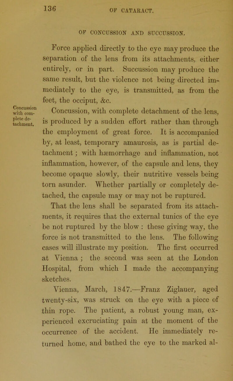 OF CONCUSSION AND SUCCUSSION. Concussion with com- plete de- tachment. Force applied directly to the eye may produce the separation of the lens from its attachments, either entirely, or in part. Succussion may produce the same result, but the violence not being directed im- mediately to the eye, is transmitted, as from the feet, the occiput, &c. Concussion, with complete detachment of the lens, is produced by a sudden effort rather than through the employment of great force. It is accompanied by, at least, temporary amaurosis, as is partial de- tachment ; with haemorrhage and inflammation, not inflammation, however, of the capsule and lens, they become opaque slowly, their nutritive vessels being torn asunder. Whether partially or completely de- tached, the capsule may or may not be ruptured. That the lens shall be separated from its attach- ments, it requires that the external tunics of the eye be not ruptured by the blow : these giving way, the force is not transmitted to the lens. The following cases will illustrate my position. The first occurred at Vienna ; the second was seen at the London Hospital, from which I made the accompanying sketches. Vienna, March, 1847.—Franz Ziglauer, aged twenty-six, was struck on the eye with a piece of thin rope. The patient, a robust young man, ex- perienced excruciating pain at the moment of the occurrence of the accident. He immediately re- turned home, and bathed the eye to the marked al-