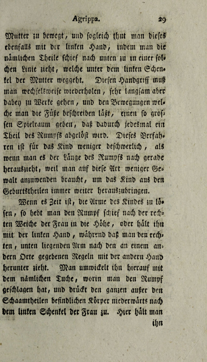 sO?u«er }u {tcreegt/ unb fogleti!) man bicftS etenfaD? mit bec liiiffn ^anb/ inbem man bic nämlKfcen tfeeile fdjtef nacft unten ju in einer fof« (t)en Stnte jie^t, meld)e unter bem Unten 0d)en* fei bet ?0?ut(ec megge^t. Stefen ^anbgtiff muß man med^feltmeife rotebet^olen, fe{)r langfam aber babei) ju^Berte geben / unb ben 33cn5egangen rceU d)e man bie güfe befcbteiben Idft, einen fo grof^ fen ©pietramn geben, bag babuttb jebeSmal ein Sbetl beS abgel6|l rntrb. ©iefeg 33erfab* ren tjl für ba? Jtinb tpeniger befdimerltcb, «l? wenn man eS ber ßdnge beS sTtumpfS natb gerabc berauSiiebt, meil man aöf biefe 3Irt roeniger @c» malt anjuinenben brantbt, um ba« finb auS ben ©eburtstbetlen immer tneiter bfr«H?5ubringen. 3genn e8 2tti bteOlrme bes ^lnbe§ ju 15* fen, fo bebt man ben Slumpf fcbief nad) ber recb» ten 2Bei(bc ber grau in bie Jpöbc, ober bdtt ibn mit bet Unten Jpanb, mdbrtnb baß man ben rt(b» fen, unten Uegenben ?Jrm nach ben an einem an» betn Dtte gegebenen Kegeln mit ber anbern ^anb beruntet jiebt. ?9?an ummicfelt ibn hierauf mit bem ndmliÄen Suche, morin man ben Kumpf gefcblagen bat, unb brücFt ben ganjen außer ben ©cbaamtbeilen befinbU^en f orper niebetmdrts nac^ betn Unten 0d)enfe( ber grau ju. ^ier bült man ibn