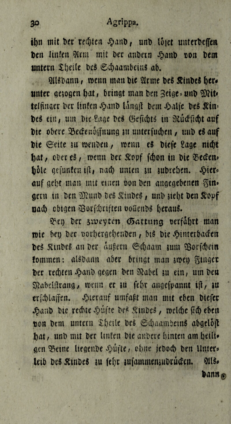 tbn mit ber' rec^teit ^ant>, unt) I6ict uutfrt>e(feft ten tinfcii Olim mit t>er antifin ^atib con bent untern tbetle beä ©^aambcin? ab. QlUbann, tvenn man bie i2lrme beS jbinbeS \)tt* unter (jeiogen feat, bringt man ben 3et8e»unb ^it* telfiuQer ber Unfcn «^aiib langjl bem ^)al|e be§ lfin> beS m\, um bte Saoe bc§ föejtcbtä in 3iÜ£fi!(t)t auf bie obere ^erfenolfnur.g lu unterfingen / imb eS auf bie ©eite ju menben, roeun e8 biefe Sage nii^t t)at / über e8, menn bet Äopf f^on in bie iSetEen» töle gfiutifeuifli nacl) unien in jubtcben. ^iet» «uf gebt mau mit einen oon ben angegebenen §in» gern in ben i5}iunb bcg finbe8» unb jiebt ben Ä'opf nad) obigen >3ütfd)rtften ooSeiibS betaui. 5^ei) ber siveytcn eSattung oerfobrt man »ie bet) ber oorbergebenben, bt8 bie v^interbaefen be8 Ä'tnbeg an ber äußern ©cbaam jum ?8orf(bfin fommcn: aUbann aber bringt man jmei) ginget ber red)ten^anb gegen benJRabel 511 ein, um ben Stabeblrang / ttcnn er ju febr angefpannt ijl., tu trfcblaifen. hierauf umfapt man mit eben btefer .^aab bie rechte e^üfte be8 .f inDc8 / mcl^c jicb eben tton bem untern ibetle beS ©d)aambnn8 abgelojl bat, unb mit ber linfen bie anbcre binten am beilt» gen '33eine Uegenbe ^üfte, ebne jeboeb ben Unter» leib bes dlinbel tu febr tufammemubrucEcn. QlU* banttg)