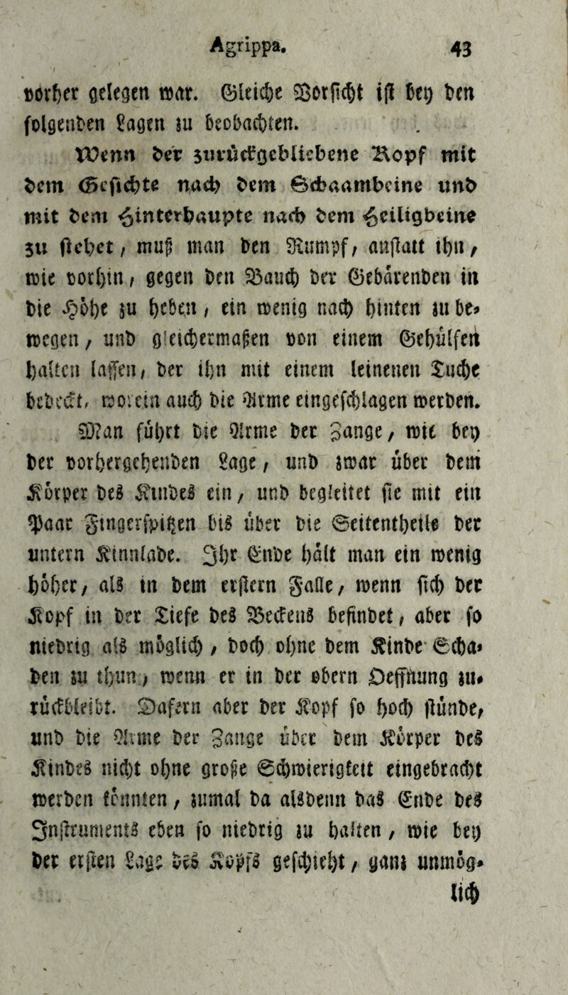 Börl^cr gelegen t»gr. ©leid)c i{l üeij fcen folgenden Jagen w 5eobact)ten. Wenn i>ev s«iücfocbltebenc Äopf mit bem <5cfj<bte nneb bem ©ribaambcinc unb mit bem ^intcrbaupte nach bem ^ciligbein« 5u Ocbet/ muf man ben Seiimpf/ anflatt t^n, wie torl)tn, gegen ben 93amti bei* ©ebdtenben in bie Jjjöbe ju t)c&en, ein menig na(i> l)in(en ju be» wegen / unb gieicbermagen »dh einem ©ebulfen baUcn iatjen, bet ifcn mit einem leinenen Smbc bcbCi^t, tsoictn auib bie Qitme elngefcbiagen werben. SHan führt bie Qlrme bet Snngc/ mit bep bet borhergehenben Sage, unb jmat übet bem Körper beS ^inbeS ein, unb begleitet jie mit ein ^aat gtngerfpib,en bi? übet bie ©citentheile bet untern ÄMnnlabe. Shr ©nbe holt man ein wenig hübet/ als in bem etjietn gatte/ wenn fiel) bet 5lbpf in bet Siefe beS 5BeifeuS befinbet, aber fo tiiebrtg als mbgli^ / hoch ol)ne bem ÄinbC'04)a» ben JU tl)un; wenn er in bet ebern Dejfhung jtt* rüefbleibt. Safetn aber bet j?bpf fo hoth jlünbe/ unb bie 9hmc bet 3ange übet bem Äütpct beS itinbeS ni(l)t ol)ne grojie ©(hwierigtett eingebracht werben fennien / jumal ba alSbeim baS ©nbe beS Snjtruments eben fo niebrig ju halten, wie bet) bet etfien Sag? bt» Äo^fS gefchieht / gani unmög» (ich