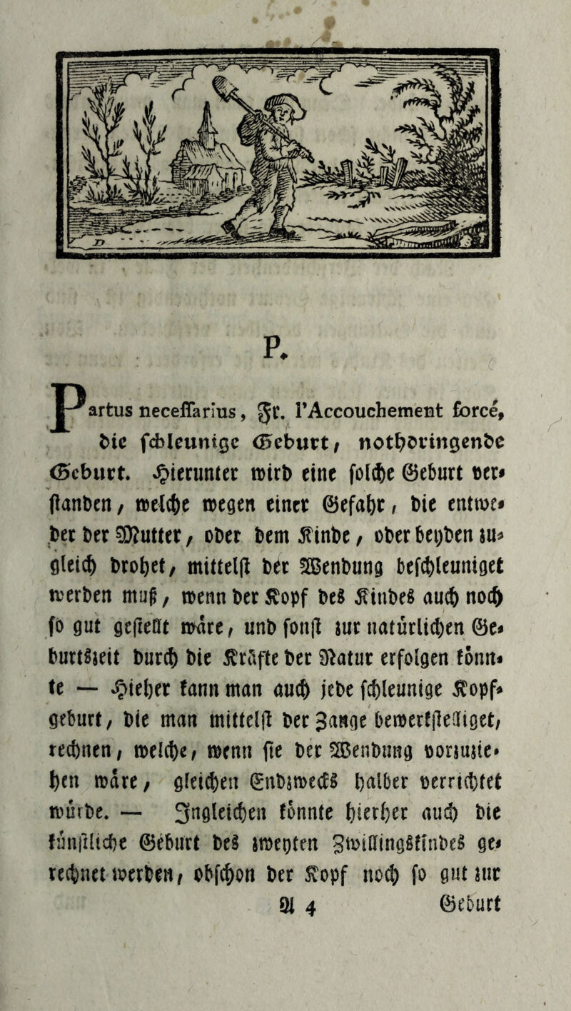 p. artus neceffarlus, TAccouchemeBt force, i)ic f<J)lcunt0c <5eburt/ not^jöcingcnbc <5cbut!t. hierunter tBtrb eine fol^)c ©ebnet »et* (ianben / »el(()c roegeit einec ©efabc; bic entroe» bee ber ?0?utter, ober bem 5?inbe / ober bei)ben iu* glei^ brobet/ mittel(l bec SEBenbuna befcbleuniget tverben muf/ »enn bet Jbopf be? j?inbe8 au^ no£^ fö gut ge(ie0t nwee / unb fon|l tue natürlt^en @e» burtSieit burd) bie J^rfifle bec Siatut erfolgen fönn* te lieber tann man au(b jebe fcbleunige Äopf» gebürt/ bie man mittelll bec 3(mge bemerfileOfiget/ rechnen; melche/ »enn jte becSEBenbimg oorjusie* hen mdre/ gleiten gnbjroeeJS halber oerrichtet würbe. ~ 3aglei^en fönnte hierher aud) bie {unfillchc ©ebnet beS jwtgten gwittinggflnbeS ge» rechnet werben; obf^on ber Sfopf no0 fo gut tue 3i 4 ©eburt