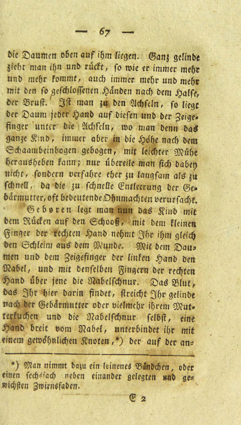 t>ic S^aumcn o5en oiif i^m Hegen. @anj geftnbe sicht man tön unb rurff, fo tvic er immer mehr unb mehr fommf, auch immer mehr unb mchc mit ben fo^erchioffenen .^(fnbcn noch bem S^alfe, ber Sruff. 31^ »««Jn S« ben 31chfcln, fo Hegf her X^Qum jeber ^onb auf biefen unb ber ^eige- ftnger unter bie Clcf)refn, mo man benn ba^ ganje Ämb, immer aber in bie jpdhe nach bem ©chaambeinbogen gebogen, mit teid)tev gjluhc heraudheben fann; nur öbereüe man ftd) babetj nicht, fonbern oerfabre eher ju langfam afsJ ju fchnett, bo bie su fc^neße Entleerung ber ©e* barmutfer, oft bebeutenbe Ohnmaditen uerucfachf. © e b 0 r c n (egt man nun ba^ ^inb mit bem 3vu(fen auf ben 6choog, mit bem fleinen ginger ber rechten ^?anb nehmt 3hr ihm gfeich ben 0chleim auö bem 0Diunbe. ?D?if bem ©aua men unb bem Zeigefinger ber linfen ^anb ben 3?abe(, unb mit tenfelben gingern ber rechten ^anb Uber fene bie D^abelfchnur. ©aö Sß(ut, 3hr -hier barin fi'nbet, ((reicht 3hi* gelinbe na(B feer ©ebdrmutter ober üielmehr ihrem 3)?ut« tcrftichen unb bie 3?abe(fchnur felbß, eine breit oom 3?abe(, unterbinbet ihr mit einem gemdhnlidien 5?notcn,*) ber auf ber an? *) 9}?an nimmt baju ein leinenem 53dnbchcn, ober einen fech^fach neben eimmber gelegten mb ge? »ichPen Zmirn^faben. E 2