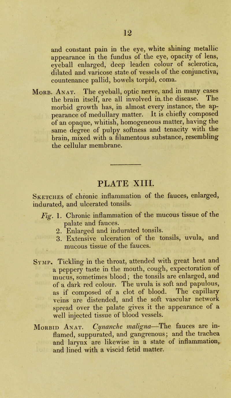 and constant pain in the eye, white shining metallic appearance in the fundus of the eye, opacity of lens, eyeball enlarged, deep leaden colour of sclerotica, dilated and varicose state of vessels of the conjunctiva, countenance pallid, bowels torpid, coma. Morb. Anat. The eyeball, optic nerve, and in many cases the brain itself, are all involved in the disease. The morbid growth has, in almost every instance, the ap- pearance of medullary matter. It is chiefly composed of an opaque, whitish, homogeneous matter, having the same degree of pulpy softness and tenacity with the brain, mixed with a filamentous substance, resembling the cellular membrane. PLATE XIII. Sketches of chronic inflammation of the fauces, enlarged, indurated, and ulcerated tonsils. Fig. 1. Chronic inflammation of the mucous tissue of the palate and fauces. 2. Enlarged and indurated tonsils. 3. Extensive ulceration of the tonsils, uvula, and mucous tissue of the fauces. Symp. Tickling in the throat, attended with great heat and a peppery taste in the mouth, cough, expectoration of mucus, sometimes blood; the tonsils are enlarged, and of a dark red colour. The uvula is soft and papulous, as if composed of a clot of blood. The capillary veins are distended, and the soft vascular network spread over the palate gives it the appearance of a well injected tissue of blood vessels. Morbid Anat. Cynanche maligna—The fauces are in- flamed, suppurated, and gangrenous; and the trachea and larynx are likewise in a state of inflammation, and lined with a viscid fetid matter. /