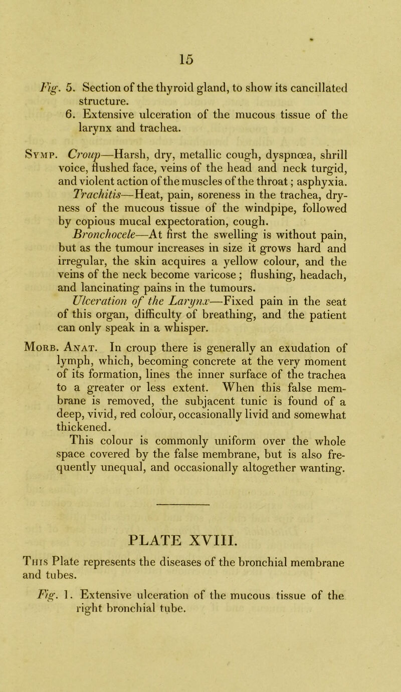 Fig. 5. Section of the thyroid gland, to show its cancillated structure. 6. Extensive ulceration of the mucous tissue of the larynx and trachea. Symp. Croup—Harsh, dry, metallic cough, dyspnoea, shrill voice, flushed face, veins of the head and neck turgid, and violent action of the muscles of the throat; asphyxia. Trachitis—Heat, pain, soreness in the trachea, dry- ness of the mucous tissue of the windpipe, followed by copious mucal expectoration, cough. Bronchocele—At first the swelling is without pain, but as the tumour increases in size it grows hard and irregular, the skin acquires a yellow colour, and the veins of the neck become varicose ; flushing, headach, and lancinating pains in the tumours. Ulceration of the Larynx—Fixed pain in the seat of this organ, difficulty of breathing, and the patient can only speak in a whisper. Morb. Ajvat. In croup there is generally an exudation of lymph, which, becoming concrete at the very moment of its formation, lines the inner surface of the trachea to a greater or less extent. When this false mem- brane is removed, the subjacent tunic is found of a deep, vivid, red colour, occasionally livid and somewhat thickened. This colour is commonly uniform over the whole space covered by the false membrane, but is also fre- quently unequal, and occasionally altogether wanting. PLATE XVIII. This Plate represents the diseases of the bronchial membrane and tubes. Fig. 1. Extensive ulceration of the mucous tissue of the right bronchial tube.
