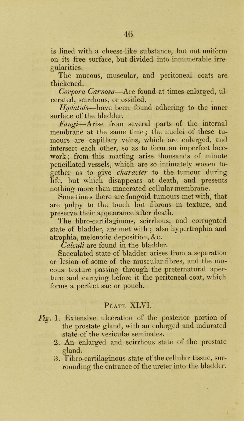 is lined with a cheese-like substance, but not uniform on its free surface, but divided into innumerable irre- gularities. The mucous, muscular, and peritoneal coats are thickened. Corpora Carnosa—Are found at times enlarged, ul- cerated, scirrhous, or ossified. Hydatids—have been found adhering to the inner surface of the bladder. Fungi—Arise from several parts of the internal membrane at the same time; the nuclei of these tu- mours are capillary veins, which are enlarged, and intersect each other, so as to form an imperfect lace- work ; from this matting arise thousands of minute pencillated vessels, which are so intimately woven to- gether as to give character to the tumour during life, but which disappears at death, and presents nothing more than macerated cellular membrane. Sometimes there are fungoid tumours met with, that are pulpy to the touch but fibrous in texture, and preserve their appearance after death. The fibro-cartilaginous, scirrhous, and corrugated state of bladder, are met with ; also hypertrophia and atrophia, melenotic deposition, &c. Calculi are found in the bladder. Sacculated state of bladder arises from a separation or lesion of some of the muscular fibres, and the mu- cous texture passing through the preternatural aper- ture and carrying before it the peritoneal coat, which forms a perfect sac or pouch. Plate XLVI. Fig. L Extensive ulceration of the posterior portion of the prostate gland, with an enlarged and indurated state of the vesiculce seminales. 2. An enlarged and scirrhous state of the prostate gland. 3. Fibro-cartilaginous state of the cellular tissue, sur- rounding the entrance of the ureter into the bladder.