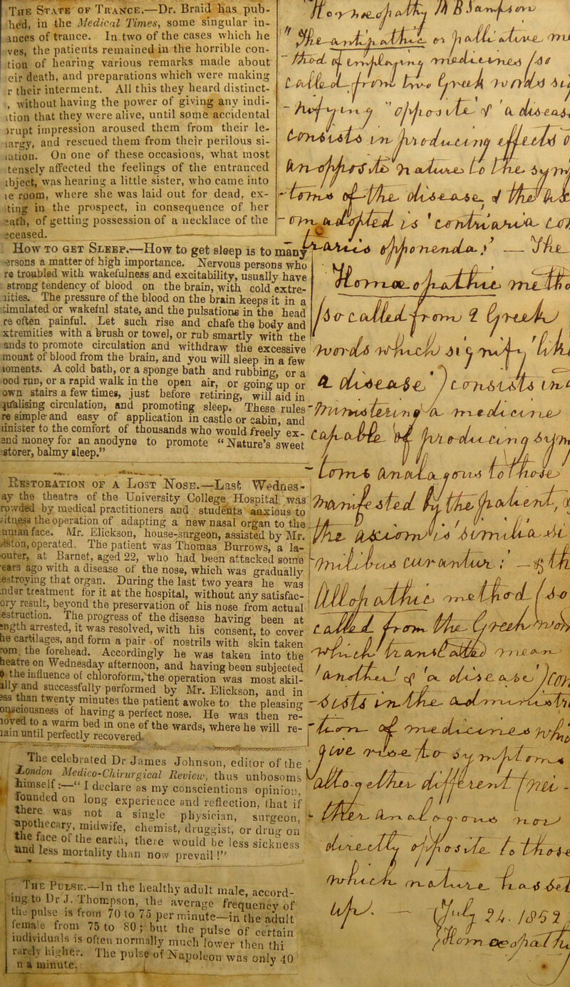 The State of Trance.—Dr. Braid has pub- hed, in the Medical Times, some singular in- inces of trance. In two of the cases which lie ves, the patients remained in the horrible con- tion of hearing various remarks made about eir death, and preparations which were making r their interment. All this they heard distinct- , without having the power of giving any indi- ition that they were alive, until some accidental I'upt impression aroused them from their le- . «rl mcnnorl tlipm frnm tiioir nPnlmiQ )i HJIjJl lar-ry, and rescued them from their perilous si- ,ation. On one of these occasions, what most tensely affected the feelings of the entranced tbject, was hearing a little sister, who came into le room, where she was laid out for dead, ex- iting in the prospect, in consequence of her aath, of getting possession of a necklace of the iceased, fto M a •’ food. l eAstv'-t- (>1 jl fr'li*. eAiyUH, drtll ('AAloL- rl~r C'tyl tyv-o frt>Ud ^ i cj ' c/j\j SsLt t'PYx J. a. du> l Cr l l/tdd of Jvi (rcLvt-LAs ?}J / i/fcc> <}x osteoid Lc How to get Seeep.—How to get sleep is to many arsons a matter of high importance. Nervous persons who re troubled with wakefulness and excitability, usually have strong tendency of blood on the brain, with cold extre- lities. The pressure of the blood on the brain keeps it in a simulated or wakeful state, and the pulsations in the head re often painful. Let such rise and chafe the body and xtremities with a brush or towel, or rub smartly with the auds to promote circulation and withdraw the excessive mount of blood from the brain, and you will sleep in a few mments. A cold bath, or a sponge bath and rubbing ora ood run, or a rapid walk in the open air, or going up own stairs a few times, just before retiring, will aid in oltd> ■ cy*14 1 LU7, oU hi^fL.xXj (T»xJ 1 if'HJbkj • A i rfJ.l own stairs a tew times, just before retiring, will aid in . / pausing circulation, and promoting sleep. These rules'^7^ L », re simple-and easy of application in castle or cabin, and bi J ^ rri € Ui4 unister to the comfort of thousands who wouldfreelv ex- ml a PJ). A L / ' t , end money for an anodyne to promote “Nature’s sweet P /Vz thoU+To'n Q f>Urh istorer, balmy sleep.” Restoration of a Lost Nose.—Lasfc Wednes- ay the theatre of the University College Hospital was rowded by medical practitioners and students anxious to Nature’s sweet /  “ TV /tt t- - ft/ O^x^Ol R (F~LZ-* ~ LcrynA> (k/rtc - I «“'f uv**v*v,«.wu dUAlUUa tv t\ f ” /J ituess t,he operation of adapting a nsw nasal organ to the .J-A V , fl . / Mr. Elickson, house-surgeon, assisted by Mr. /TlZ- L>4 f>07TT iCl . 1 hfi mf.lflnf. TVflQ T hnmcia Rn 1-1 1 n a uman face /istoa,operated. The patient was Thomas Burrows, a la oufer, at barnet, aged 22, who had been attacked some ears ago with a disease of the nose, which was gradually estroying that organ. During the last two years he was .nder treatment for it at the hospital, without any satisfac- ory result, beyond the preservation of his nose from actual estruction. The progress of the disease having been at ;ngth arrested, it was resolved, with his consent, to cover he cartilages, and form a pair of nostrils with skin taken rom the forehead. Accordingly he was taken into the heat re on , Wednesday afternoon, and having been subjected *, the mfluence of chloroform,'the operation was most skil- ou, ,0 ^dJedU to the„J-A- V / /r /. .-5 lc I 71 ' j > aM-C'-' jAl \ O'TLt’'luyf?~csid> Cdd/)*-Oi/y\^AASL ^ - DM-oji oJJLl t(i<rcL (J-i <n*x- if*- 'vtlJJfc. OuyxAL 0^7 LC ts- o . Ul ^uiuxuiuriu, rue operation was most skil- ^ 'pi. YL 0^4 o J/’/j illy and sueeessfuHy performed by Mr. Elickson, and in y U__ . \ f / ' A t :s . n twentJ minutes the patient awoke to the pleasinn- oqsciousness of havin;? a nerfepf-. __ . . ^ S0^3 °f ^aViDg a perfect nose- He was tijea re- ^ . , > MJ,✓ AV’X’AAJSA7IX.. Q (a>£~ 0*17L, The celebrated Dr James Johnson, editor of the ' / , XondoM Medico-Cl dr urgical Review, thus unbosoms ^ A/A himself; “ I declare as my conscientious opinion, founded on long experience and reflection, that if Hfr/~ there was not a single physician, surgeon, the f^arV\flldW,fe’ chemist- druggist, or drug on the face °f the earth, there would be less sickness and less mortality than now prevail!” fU /Lo-x r. A, T-rln tlie h?hhy adult accord- mn to l)r J. lhompson, the average frequency of the pulse is from 70 to 75 per minute—in the adult female from 75 to 80; but the pulse of certain individuals is often normally much lower then thi rarely higher. The pulse of Napoleon was only 40 n a minute. y 1 er t-i— ttXrr S toiAt <n~ x ij ^ ’(fAryr,