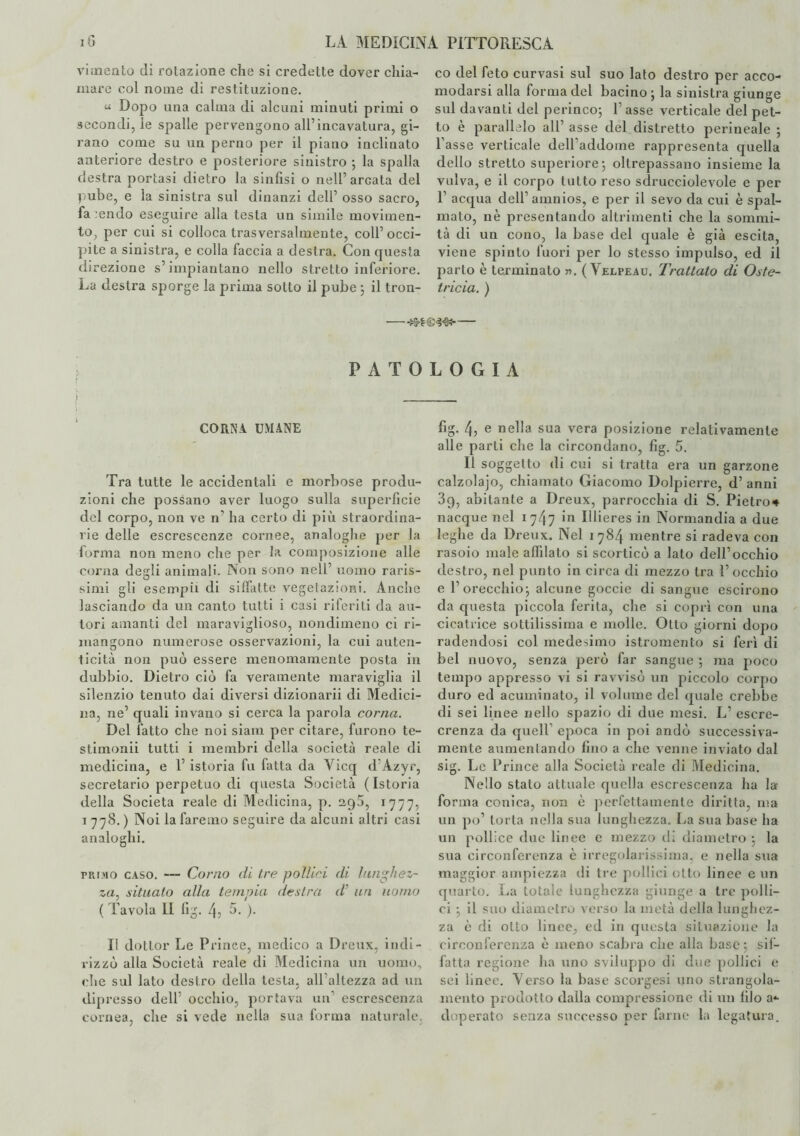 vimento di rotazione che si credette dover chia¬ mare col nome di restituzione. u Dopo una calma di alcuni minuti primi o secondi, le spalle pervengono all’incavatura, gi¬ rano come su un perno per il piano inclinato anteriore destro e posteriore sinistro ; la spalla destra portasi dietro la sinfisi o nell’arcata del pube, e la sinistra sul dinanzi dell’ osso sacro, facendo eseguire alla testa un simile movimen¬ to, per cui si colloca trasversalmente, coll’occi¬ pite a sinistra, e colla faccia a destra. Con questa direzione s’impiantano nello stretto inferiore. La destra sporge la prima sotto il pube ; il tron¬ co del feto curvasi sul suo lato destro per acco¬ modarsi alla forma del bacino ; la sinistra giunge sul davanti del perineo; l’asse verticale del pet¬ to è parallelo all’ asse del distretto perineale ; l’asse verticale dell’addome rappresenta quella dello stretto superiore; oltrepassano insieme la vulva, e il corpo tutto reso sdrucciolevole e per 1’ acqua dell’amnios, e per il sevo da cui è spal¬ mato, nè presentando altrimenti che la sommi¬ tà di un cono, la base del quale è già escita, viene spinto fuori per lo stesso impulso, ed il parto è terminato ». ( Velpeau. Trattalo di Oste¬ tricia. ) -— PATOLOGIA i _ CORNA UMANE Tra tutte le accidentali e morbose produ¬ zioni che possano aver luogo sulla superficie del corpo, non ve n’ ha certo di più straordina¬ rie delle escrescenze cornee, analoghe per la forma non meno che per la composizione alle corna degli animali. Non sono nell’ uomo raris¬ simi gli esempli di siffatte vegetazioni. Anche lasciando da un canto tutti i casi riferiti da au¬ tori amanti del maraviglioso, nondimeno ci ri¬ mangono numerose osservazioni, la cui auten¬ ticità non può essere menomamente posta in dubbio. Dietro ciò fa veramente maraviglia il silenzio tenuto dai diversi dizionarii di Medici¬ na, ne’ quali invano si cerca la parola corna. Del fatto che noi siain per citare, furono te- stimonii tutti i membri della società reale di medicina, e 1’ istoria fu fatta da Yicq d’Azyr, secretarlo perpetuo di questa Società (Istoria della Società reale di Medicina, p. aq5, 1777, 1 778. ) Noi la faremo seguire da alcuni altri casi analoghi. trivio caso. — Corno di tre pollici di lunghez¬ za^ situalo alla tempia destra d' un uomo ( Tavola II lìg. 4? 5. ). Il dottor Le Prince, medico a Dreux, indi¬ rizzò alla Società reale di Medicina un uomo, che sul lato destro della testa, all’altezza ad un dipresso dell’ occhio, portava un’ escrescenza cornea, che si vede nella sua forma naturale. fig. 4, e nella sua vera posizione relativamente alle parli che la circondano, fig. 5. Il soggetto di cui si tratta era un garzone calzolajo, chiamato Giacomo Dolpierre, d’ anni 39, abitante a Dreux, parrocchia di S. Pietro# nacque nel 1747 >n IHieres in Normandia a due leghe da Dreux. Nel 1784 mentre si radeva con rasoio male affilato si scorticò a lato dell’occhio destro, nel punto in circa di mezzo tra l’occhio e 1’orecchio; alcune goccie disangue escirono da questa piccola ferita, che si coprì con una cicatrice sottilissima e molle. Otto giorni dopo radendosi col medesimo istromento si ferì di bel nuovo, senza però far sangue ; ma poco tempo appresso vi si ravvisò un piccolo corpo duro ed acuminato, il volume del quale crebbe di sei linee nello spazio di due mesi. L’ escre- crenza da quell’ epoca in poi andò successiva¬ mente aumentando fino a che venne inviato dal sig. Le Prince alla Società reale di Medicina. Nello stalo attuale quella escrescenza ha la forma conica, non è perfettamente diritta, ma un po’ torta nella sua lunghezza. La sua base ha un pollice due linee e mezzo di diametro ; la sua circonferenza è irregolarissima, e nella sua maggior ampiezza ili tre pollici otto linee e un quarto. La totale lunghezza giunge a tre polli¬ ci ; il suo diametro verso la metà della lunghez¬ za è di otto linee, ed in questa situazione la circonferenza è meno scabra che alla base; sif¬ fatta regione ha uno sviluppo di due pollici e sei linee. Terso la base scorgesi uno strangola¬ mento prodotto dalla compressione di un filo a*- doperato senza successo per farne la legatura.