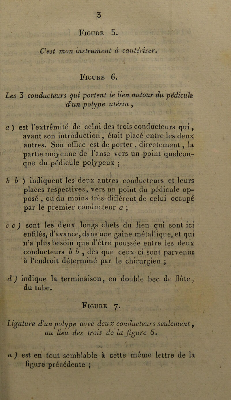 Figure 5. C'est mon instrument à cautériser. Figure 6. Les 3 conducteurs gui portent le lien autour du pédicule d'un polype utérin , a ) est Vextrêmité de celui des trois conducteurs qui, avant son introduction , était placé entre les deux autres. Son office est de porter , directement , la partie moyenne de l'anse vers un point quelcon- que du pédicule polypeux ; b b ) indiquent les deux autres conducteurs et leurs places respectives, vers un point du pédicule op- posé , ou du moins très-différent de celui occupé par le premier conducteur a ; cc) sont les deux longs chefs du lien qui sont ici enfilés, d’avance, dans une gaine métallique, et qui n’a plus besoin que d’être poussée entre les deux conducteurs b b , dès que ceux-ci sont parvenus à l’endroit déterminé par le chirurgien ; d ) indique la terminaison, en double bec de flûte, du tube. Figure 7. Ligature d'un polype avec deux conducteurs seulement, au lieu des trois de la figure 6. M • } a ) est en tout semblable à cette même lettre de la figure précédente ;