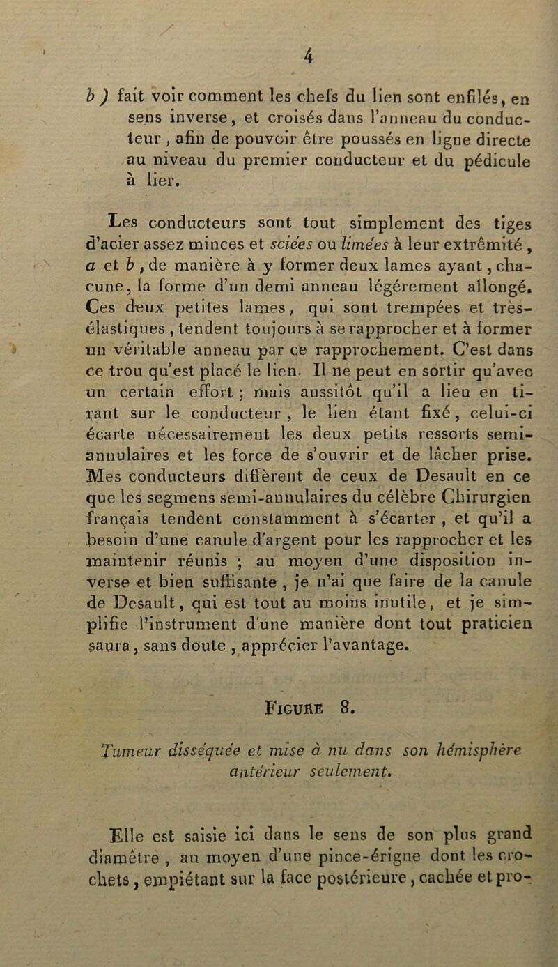 b ) fait voir comment les chefs du lien sont enfilés, en sens inverse, et croisés dans l’anneau du conduc- teur , afin de pouvoir être poussés en ligne directe au niveau du premier conducteur et du pédicule à lier. Les conducteurs sont tout simplement des tiges d’acier assez minces et sciées ou limées à leur extrémité , a et b , de manière à y former deux lames ayant, cha- cune, la forme d’un demi anneau légèrement allongé. Ces deux petites lames, qui sont trempées et très- élastiques , tendent toujours à se rapprocher et à former un véritable anneau par ce rapprochement. C’est dans ce trou qu’est placé le lien- Il ne peut en sortir qu’avec un certain effort ; mais aussitôt qu’il a lieu en ti- rant sur le conducteur , le lien étant fixé, celui-ci écarte nécessairement les deux petits ressorts semi- annulaires et les force de s’ouvrir et de lâcher prise. Mes conducteurs diffèrent de ceux de Desault en ce que les segmens semi-annulaires du célèbre Chirurgien français tendent constamment à s’écarter , et qu’il a besoin d’une canule d'argent pour les rapprocher et les maintenir réunis ; au moyen d’une disposition in- verse et bien suffisante , je n’ai que faire de la canule de Desault, qui est tout au moins inutile, et je sim- plifie l’instrument d'une manière dont tout praticien saura, sans doute , apprécier l’avantage. Figure 8. Tumeur disséquée et mise à nu dans son hémisphère antérieur seulement. Elle est saisie ici dans le sens de son plus grand diamètre , au moyen d’une pince-érigne dont les cro- chets , empiétant sur la face postérieure, cachée et pro-