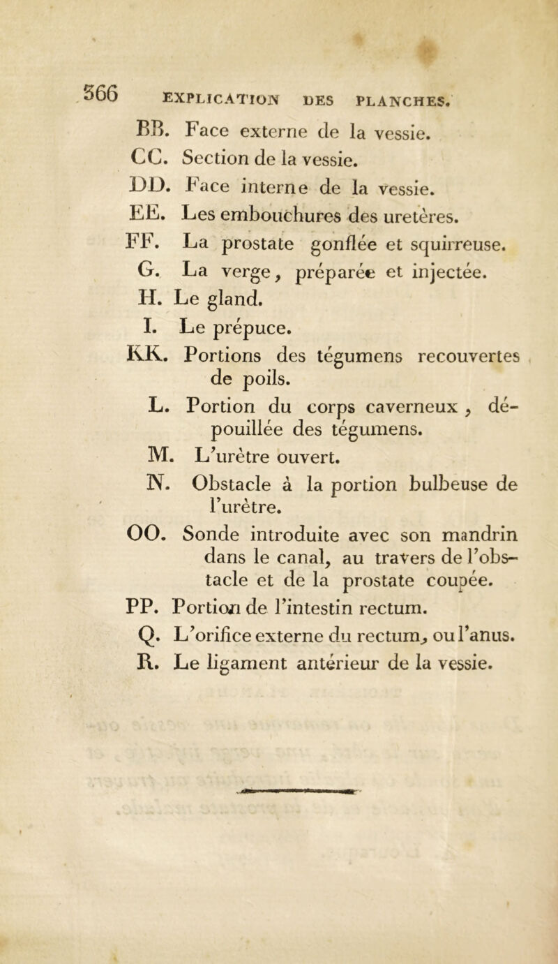 .566 BR. Face externe de la vessie. CC. Section de la vessie. DD. P ace interne de la vessie. EE. Les embouchures des uretères. FF. La prostate gonflée et squirreuse. G. La verge, préparée et injectée. H. Le gland. I. Le prépuce. KK. Portions des légumens recouvertes de poils. L. Portion du corps caverneux , dé- pouillée des tégumens. M. L^ urètre ouvert. N. Obstacle à la portion bulbeuse de l’urètre. 00. Sonde introduite avec son mandrin dans le canal, au travers de l’obs- tacle et de la prostate coupée. PP. PortioLi de l’intestin rectum. Q. L’orifice externe du rectum^ ou l’anus. R. Le ligament antérieur de la vessie.