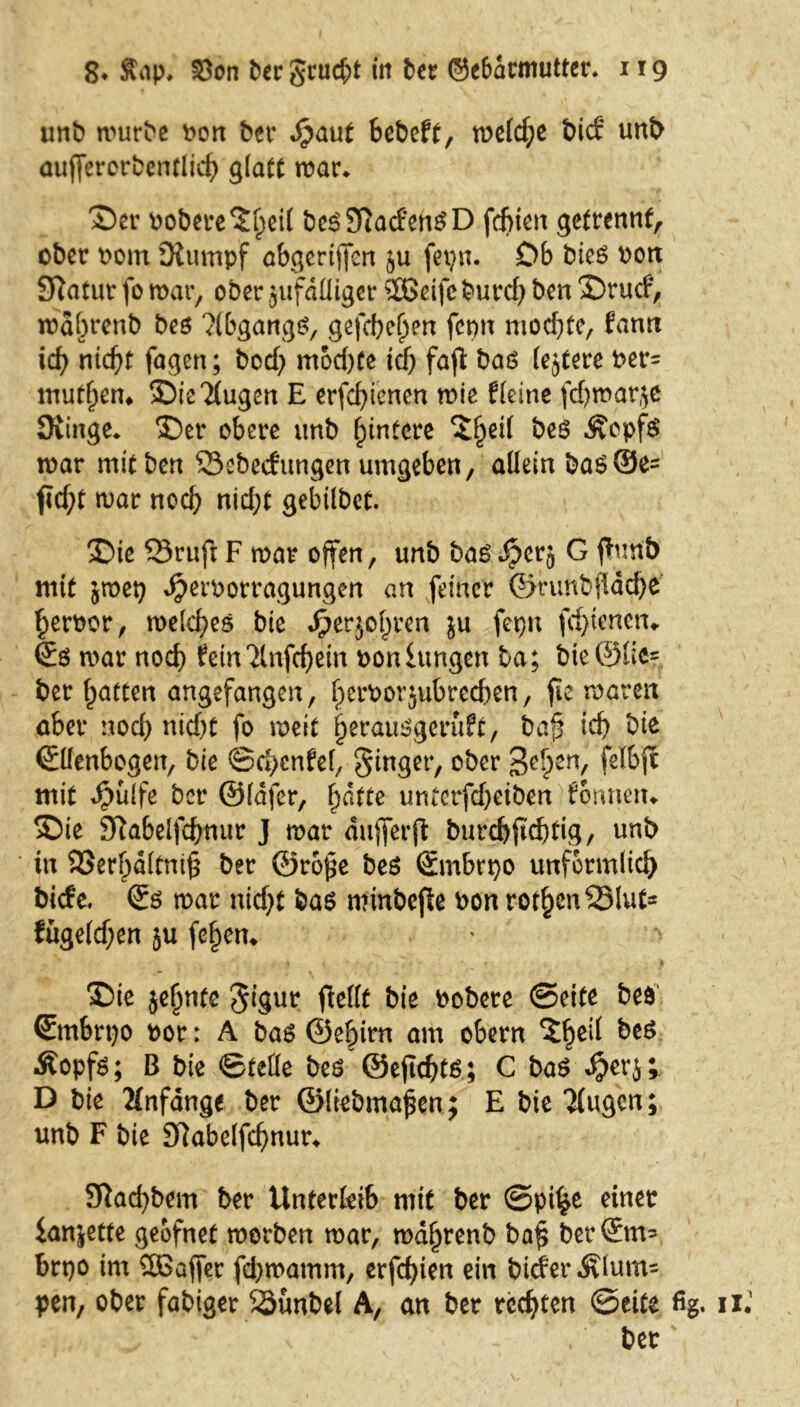 unb mürbe t>on ber «£aut bcbeft, meld;e bid unb auffererberttltc^) glatt mar* ©er oobere^eil beßKacfenßD fcf>ien getrennt, ober Pom Kumpf obgertjfen ju fepn. Ob bieß Pott Statur fo mar, ober jufdlUger 2Beifcburd) ben ©rucf, mdbrenb beß ?(bgangß, gefcbefjen fcmt mochte, fann ich nid)t fagen; bod) mod)te ich fajl baß (ejtere Per= mutten* ©ie klugen E erfchtcnen mie kleine fdjmarjc üiinge* ©er obere mtb hintere ?§eil beß Äopfß mar mit ben ©ebecfungen umgeben, allein baß©e= fld;t mar noch nid;t gebilbet. ©te Sruft F mar offen, unb baßSpirj G funb mit jmep Jjeroorragungen an feiner ©runb|idd}e heroor, melcfyeß bie $er$ol)ren ju fepu fchtenen«. Eß mar noch ^etrt 2lnf(f)etn ooniungen ba; bte@üe= ber Ratten angefangen, (mmorjubrcdKn, fie marett aber nod) nid)t fo meit f)eraußgeru?t, bap id) bie Ellenbogen, bie ©dientet, ginger, ober 3c£erV mit Jpulfe ber ©lafer, hatte unierfd)etben tonnen«. ©ie Sftabelfdjnur J mar duffcrft burd)ftd)tig, unb in S23crf)dltnt§ ber @ro£e beß Embrpo unförmlich biefe. Eß mar nicht baß minbefle Pon rot§en25lut- fügeld)en ju [ehern ©ie je^ntc gigur ftellt bie Pobere ©eite beß Embrpo por: A baß ©ef)irn am obern ^eil beß Äopfß; B bie ©teile beß ©ejtchtß; C baß «^erj; D bie Anfänge ber ©ltebma£en; E bie Tlugcn; unb F bie Kabelfchnur* 9iad)bem ber Unterleib mit ber @pi£e einer ianjette geofnet morben mar, md^renb ba§ berEm= brpo im Sßafjer fd)mamm, erfd)ien ein biderÄlum^ pen, ober fähiger SÜünbel A, an ber rechten ©eite %. 11. bet