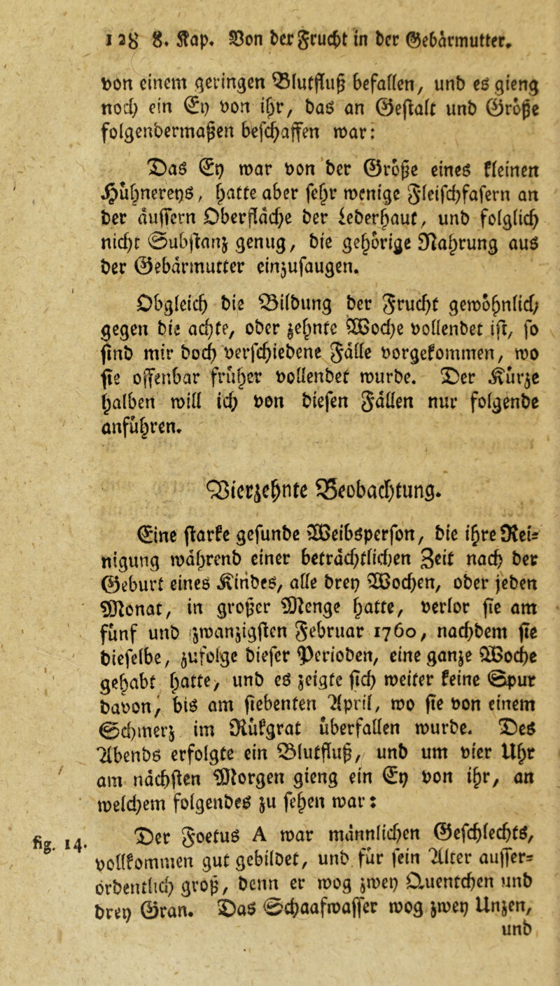 bon einem geringen ©lutjluf} befallen, unb esgieng nod} ein St} bon i(jr, baS an ©eftalt unb ©rbjje folgenbermaj$en befd}affen mar: OaS St} mar bon ber ©ro£e eines ffetnen djmbnerepS, hatte aber fefjr ment'gc §feifd}fafern an ber duffem Oberfläche ber ieber^auf, unb folglich nicht ©ufejtanj genug, bie gehörige Stauung aus ber ©ebdrmutter einjufaugen. Obgleich bie Q3i(bung ber Frucht gemohnlid; gegen bie ad}fe, ober §ef)nfc Sßod}e bollenbet ift, fo ftnb mir bod} bcrfd}iebcne $dlle borgefomtnen, mo fie offenbar früher boüenbef mürbe. X)er Äurje falben mill id; bon biefen §düen nur folgenbe anführen. Q3icriehnte Beobachtung. Sine flarfc gefunbe 2Beibsperfon, bie ihreStetV ttigung mdljrenb einer betrdd}tlid)en %tit nach ber ©eburt eines Jvtribes, alle bret} 5Bod)en, ober jeben ' Sionat, in großer Stenge hatte, berlor fte am fünf unb jmanjtgjlcn gebruar 1760, nadjbent fte biefelbe, jufolge biefer ^PerioDen, eine ganje 5Bod)e gehabt f^tte, unb es jeigfe ftd} meifer feine ©pur babon, bis am ftebenfen Tlpril, mo fte bon einem ©d)mer$ im SRüfgrat überfallen mürbe. T)eS Tlbenbs erfolgte ein SMuffluß, unb um hier Uhr am ndcbflen Slorgen gieng ein St} bon ihr, an meld}em folgenbes JU fehen mar: fior 14. £>er §oetuS A mar mdnnlid}en ©efd)led}ts, bollfommen gut gebilbet, unb. für fein TUter aufifer* örbentltd} groß, Denn er mog jmet} Omentchen unb bret} ©ran. £>aS ©chaafmajfer mog jmet} Un$en, unb