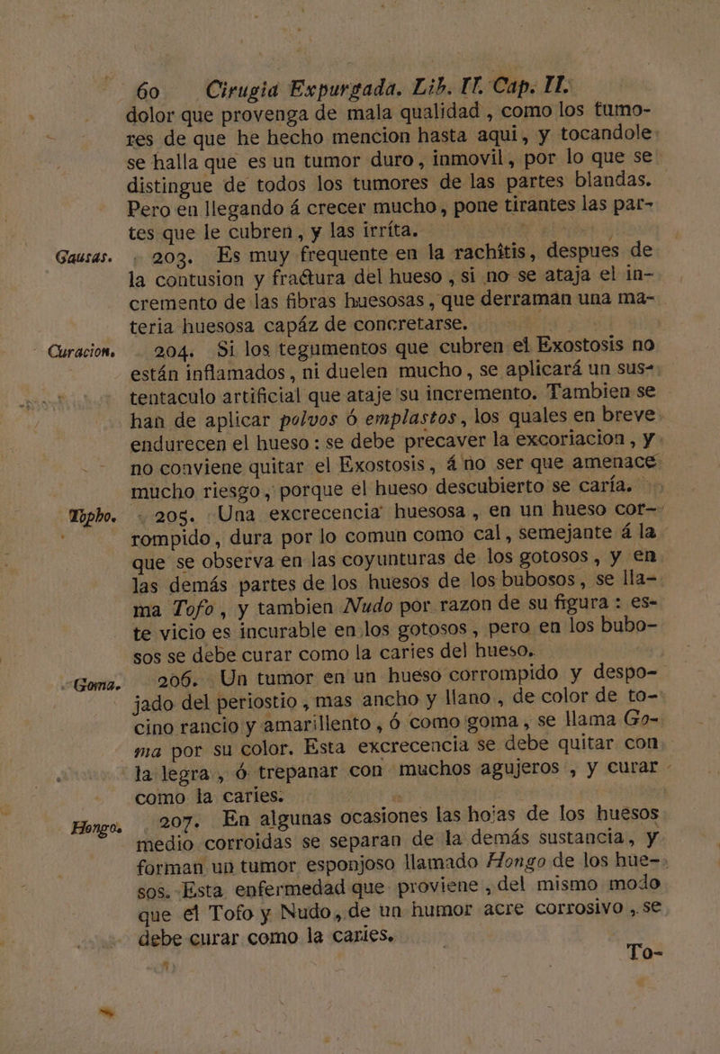 Gausas. - Curacióto Goma. - Hongos 60 Cirugia Expurgada. Lib. T E Cap. IT. dolor que provenga de mala qualidad , como los tumo- distingue de todos los tumores de las partes blandas. Pero en llegando á crecer mucho, pone tirantes las par» tes que le cubren, y las irríta. de 203. Es muy frequente en la rachítis, despues de la contusion y fraétura del hueso , si no se ataja el in- teria huesosa capáz de concretarse. bl 204. Si los tegumentos que cubren el Exostosis no están inflamados, ni duelen mucho, se aplicará un sus- tentaculo artificial que ataje'su incremento. Tambien se mucho riesgo , porque el hueso descubierto se caría. las demás partes de los huesos de los bubosos, se lla= ma Tofo, y tambien Nudo por razon de su figura : es- te vicio es incurable en.los gotosos , pero en los bubo- sos se debe curar como la caries del hueso,. jado del periostio , mas ancho y llano, de color de to= como la caries. a : 207. En algunas ocasiones las hoias de los huesos sos. Esta enfermedad que proviene , del mismo modo que el Tofo y Nudo, de un humor acre corrosivo ,.se debe curar como la caries. Mm pie To- Xx