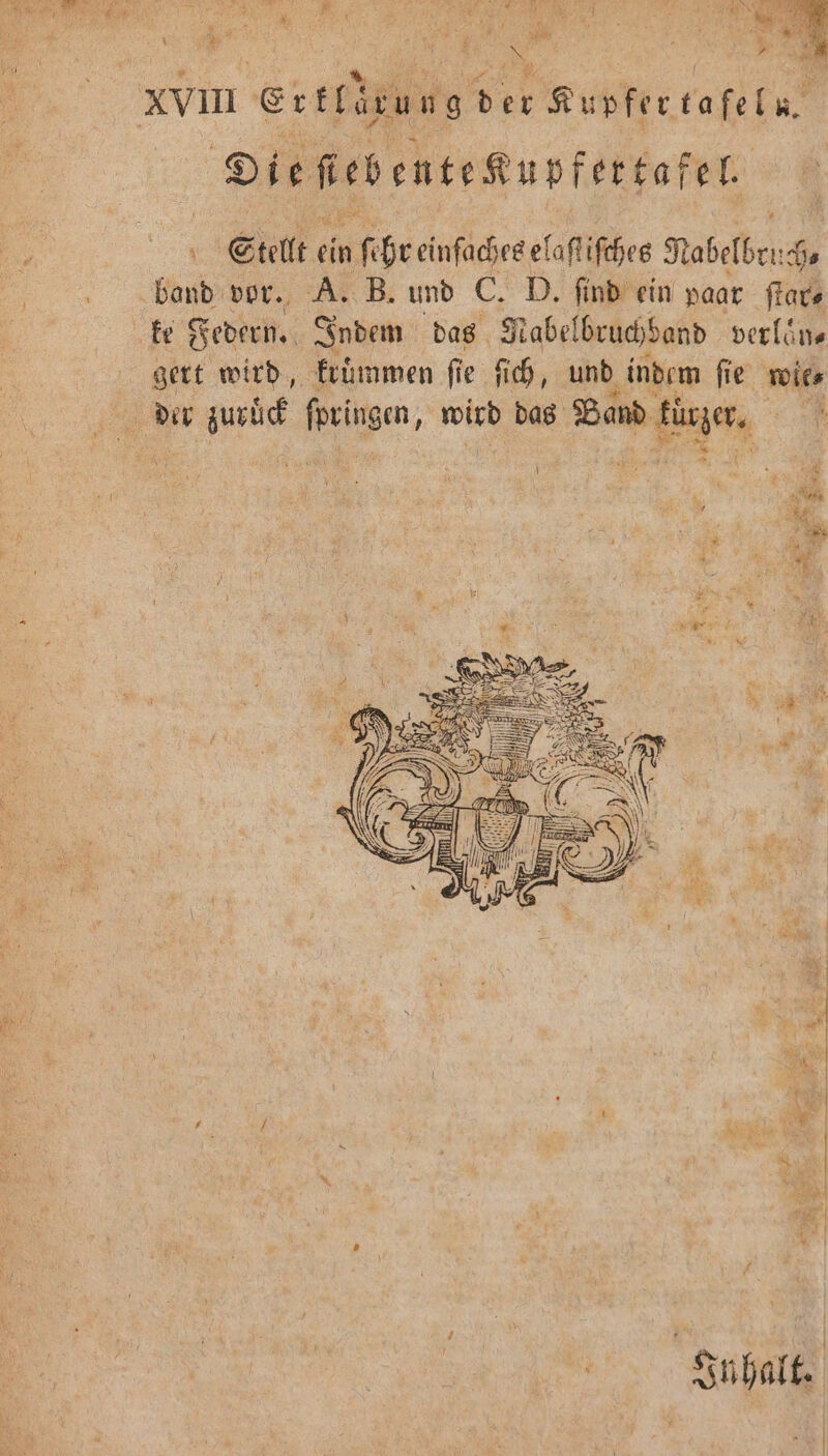 * 6 * l . 7 . kin 5 0 - ; x . TE N = . \ e * “ 5 4 * PL * „ XVII E der Kupfer tafel u. Die ſtebenteKupfertafel Stellt ein ſehr einfaches elaſt iſches Nobelbr. ch⸗ band vor. A. B. und C. ſind ein paar ſtar⸗ ke Federn. Indem das Nabelbruchband verlaͤn⸗ gert wird, krummen fie ſich, und indem ſie wie⸗ der zuruͤck leise, wird das Band gun