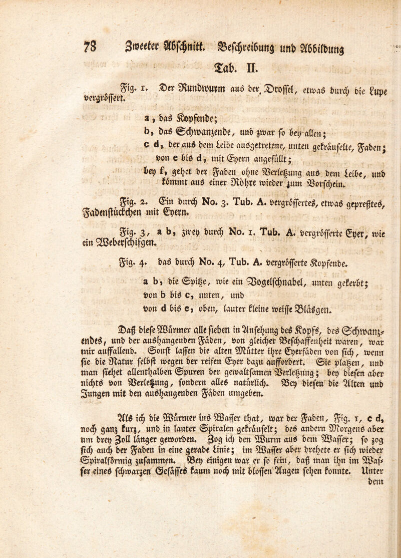 m II. $'3* i. £>er ÜfomtWUW auö ber £>poffel, etwas burdj bie fW öcvgroffeit. a, bas Äopfenfce; b, öaS ©cpraanjenöc, unb jwar fo &ep allen; cd, ber au$ bem leibe ausgetretene, unten gef raufette, $abenj t>ou e bis d, mit (Sperrt ungefüllt; bep f, gepet ber gaben opne Verlegung anS bem leibe, unb fömmt auS einer fRbpte tvieber jum 5Botfd;ein. a. ©n bureg No. 3. Tub. A. bergrbfferteg, etmag gepreßte#, SabenftucEcgen mit Cpwt* gtg. 3, ab, jmep bureg No. i. Tub. A. bergrfjferte gytx, me ein ^ebetfefnfgett. $tg* 4. bag bureg No. 4, Tub. A. bergräfferte Äopfenbe. a b, bie ©ptge, mie ein QSoselfc^nabet, unten gelevH; bon b big c, unten, unb bon d big e, oben, lauter Steine n?etffe $8(äggen. 2)a$ biefeSBurmer alle fiebert in 3lufegung be# ^opf#, beg (spdgtuanj* enbe#, unb ber auggangenben Jähen, bon gleichet 93efegaffengeit maren, mar mir auffallend ©ottf! laffen bie alten SDTutter igre Stjerfabett bon fteg, menn fte bie Statur felbjl megen ber reifen (5t>er baju aufforbert. ©te plagen, unb man fuget alleutgalben ©puren ber gemaltfamcn Verlegung; bet) biefen aber tticgtg bon Verlegung, fonbern alleg natürlich 95etj biefen bie eilten unb Sangen mit ben auggangenben Jäben umgeben. 3(1# icg bie 5Bfirmer mg SBaffer tgat, mar ber Jaben, Jtg, x, c d, uoeg ganj fur$, unb in lauter ©pxralen geträufelt; beg anbern SJtorgeng aber um brep länger geworben. *4 ben 2Burm aug bem SBajfer; fo jog fteg aueg ber Jabcn in eine gerabe linte; int Sßaffer aber bregete er fieg mteber ©piralfärmig jufammen. 95ep einigen mar er fo fern, bag man tgn im Söaf* fer eineg fcgmar$en ©efäffeg Saum noeg mit biogen klugen fegen Eonnte. Unter bem