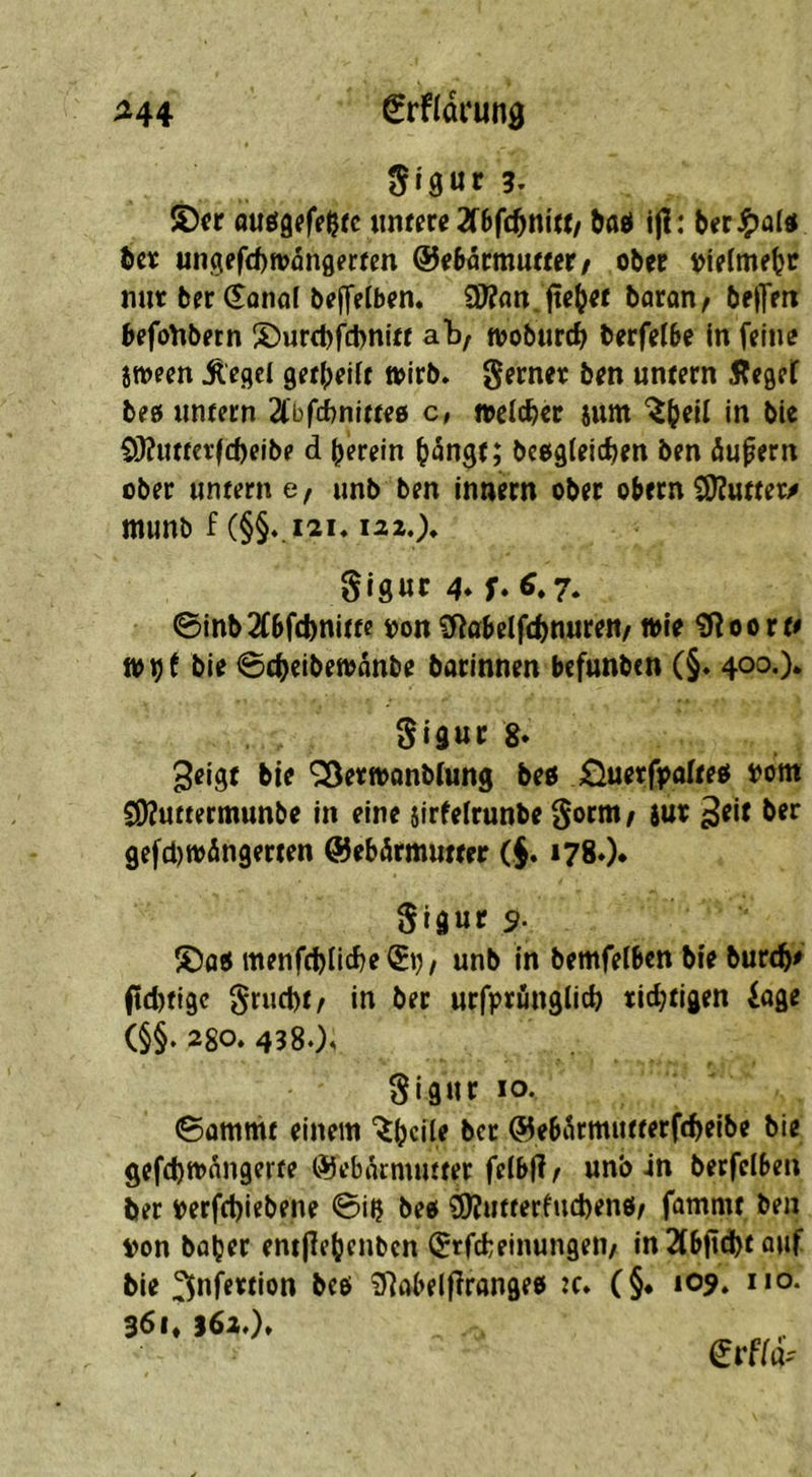 M4 €tfldmg ÜfSUt 3. ouög^feßrc untere 2(bf(^nitt/ ^aö ijl: berJ^al« bcr «ngefd)tt>5nflfrKn &ebatmutterf ob« »ielmebc nur b« ^onof beffelbem £D?an. ftc^« boran/ bf|Tf« bffo^betn S)urd)fcbni« ab, »obiircb berfelbe in fflne itoeen Äegcl Qetl^eilt toirb. b^n untern Äeget beo untern 2Cbfd)nltte0 c, wdd)er sum C))?utt€rf(l)elbe d herein b^ngt; bcogieictjen ben öupern ober untern e, unb ben Innern ober obern S)?uttew munb f (§§vi2i. laz.;* giguc 4* f» 6*7* 0inb2f6fcbnitte »on flRabeift^nureW/ »le ^oort# »hf bie 0cbeiben>flnbe batinnen befunbtn (§. 400,)* Siguc 8. 3eigt bie ^ertt>onOlung beö jQuerfpalteo t>om SO?uttermunbe In eine sirfelrunbe Sorni/ jut gefci)tt>än9erten ©ebörmutter (§. i780* Sigur 9. S)atimenfcblicbe(5t), unb in bemfelbcnbieburcb# fld)fi9c §ruct)t/ in ber urfpröngiicb richtigen iage (§§. 280. 4380^ Sigur 10. 0ümmt einem “^bcdf ®e65rmutterf(f)eibe bie gefcbrnnngerte ®ebacmmter felbfir unb in berfelben ber »erfcbiebene 0ih beo 9)?utferfucl)en0r fommt ben von bflb^r entjiebenbcn (^rfcheinungeu/ In 2lb|id)t onf bie 3n^«lon bee ^Rabeifirangee :c. (§♦ 109. no. 361* 362.).