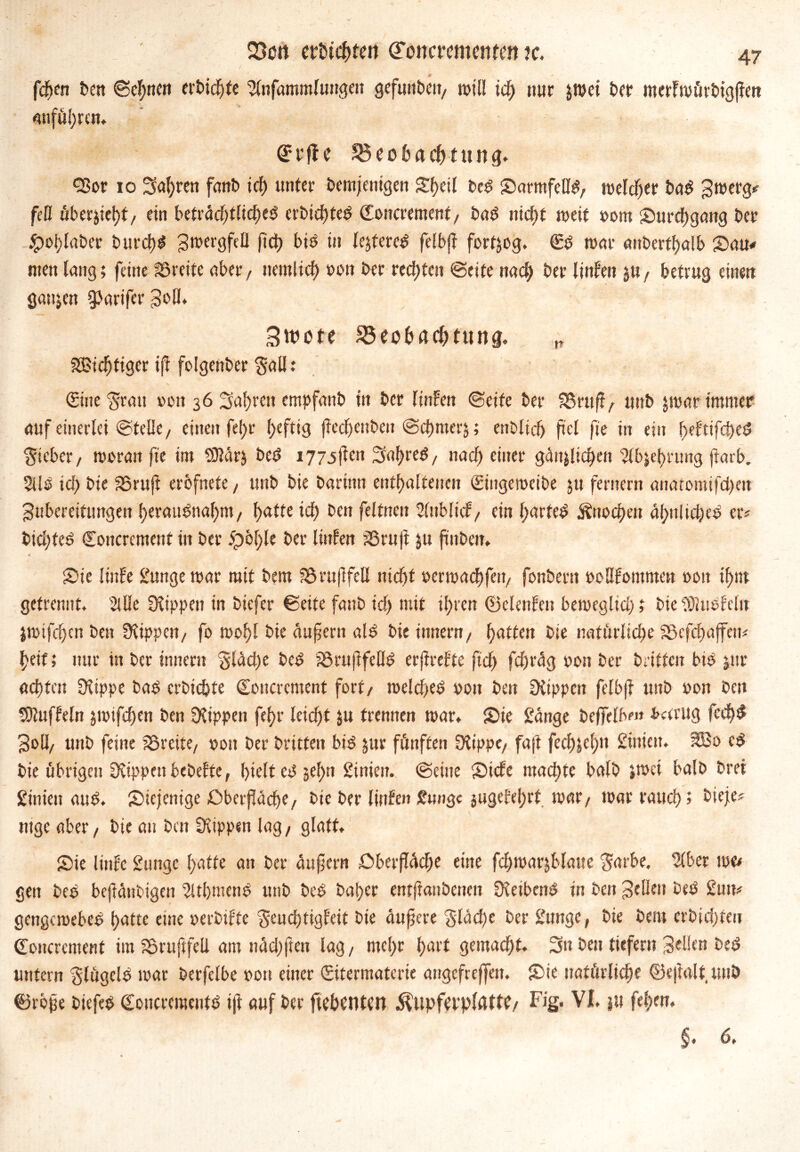 fd)cn ben ©ebnen erbidjte 'SInfammluHgen gefunden/ will id) nur jwei ber merFmürbigjfen anführen. Beobachtung. Q3or 10 3al)ren f<m£> ich unter bemjenigen Shell bed SarmfeHd/ meldjer bad Z^erg* fett übergeht, ein betväd)tüd)t$ crbid)ted Concrement, bad nicht weif pom Surd)gang ber £>oi)laber burch* 3n>ergfclt (td) bid in lejfered fefbfl fortjog. Cd mar anderthalb Sam» men lang; feine SSreite über/ nemlich pon ber rechten ©eite nach ber lüden $U/ betrug einen ganzen QJarifer goß. Sroote Beobachtung. n «Sichtiger ift folgenber gall: (Eine $rau »01t 36 2>al)reit empfand in ber lüden ©eite ber Bruft/ uttb jmar immer auf einerlei ©teile / einen fehr heftig jtechenben ©chmerj; endlich fict fie in ein beWfcheS lieber/ moran fie im 93?är$ bed i77.sjteit 3al)red/ nach einer geliehen 2%ct)nmg jiarb. 2Ud ich bie SSrujt erbfnete/ unb bie barinn enthaltenen Cingemcibe ju fernem anatomifd)en Zubereitungen heraudnaljm/ fjatte id) ben feltncn Slnblicf/ ein l;arted Knochen äl)nlid)ed er* bid)ted Concrement in ber 5pöf)le ber Unten 23ru)t ju frnben. Sie lüde Sungemar mit bem fSruftfcll nicht permachfeit/ fonbertt poßfommeu oott ihm getrennt. sMe Rippen in biefer ©eite fanb id) mit ihren ©elenfeit bemegltd); bieiöluefclu jmtfd)cn ben Rippen/ fo toohl bie aufern ald bie innem/ f>attcn bie natürliche 93cfd)ajfcn* heit; nur in ber innern gladje bed jöruftfeßd er|trefte ftd) fd)rag oott ber britten bid jur achten Ü?ippe bad erdichte Concrement fort/ melched poit ben üiippen fclbß unb pon ben Muffeln 5toifd)en ben Rippen fehr leicht 51t trennen mar. Sie Sange beffclbm JMrug feehd Zoll/ unb feine iSreite, pon ber britten bid jur fünften Oiippe/ fajt fechjel;n Süden. 3Bo ed bie übrigen üeippeubebetfe, hielt cd 5el)n Stnieu. ©eine Side mad)te balb ;mei halb brei Sinien aud. Siejenige Sberfache/ bie ber linfen £nngc jugebehrf mar*/ mar rauch? ^ieje* ntge aber, bie au ben SKippen lag, glatt. Sie lüde Sungc hatte an ber üufern £>berfi<khe eine fd)marjblaue $arbe. Slber me# gen bed beendigen 2ltl)mend unb bed baher entftanbenen Reibend in ben Zellen bed Sun* gengemebed hatte eine perbtfte $eud)tigfeit bie äußere Stäche ber Sunge, bie bem erbid)teu Concrement im SSruftfeU am nüd)ften lag/ mc!)r hart gemacht. 3» ben tiefem Zellen bed untern $lügcld mar berfelbe pon einer Citermaterie angefreffen. Sie natürliche ©eftalt unb ©röjje biefed Concrcmeutd ift auf ber ftehcntCU $upfcrp(AftC/ Fig. VI. jit fel)en. §. <5.
