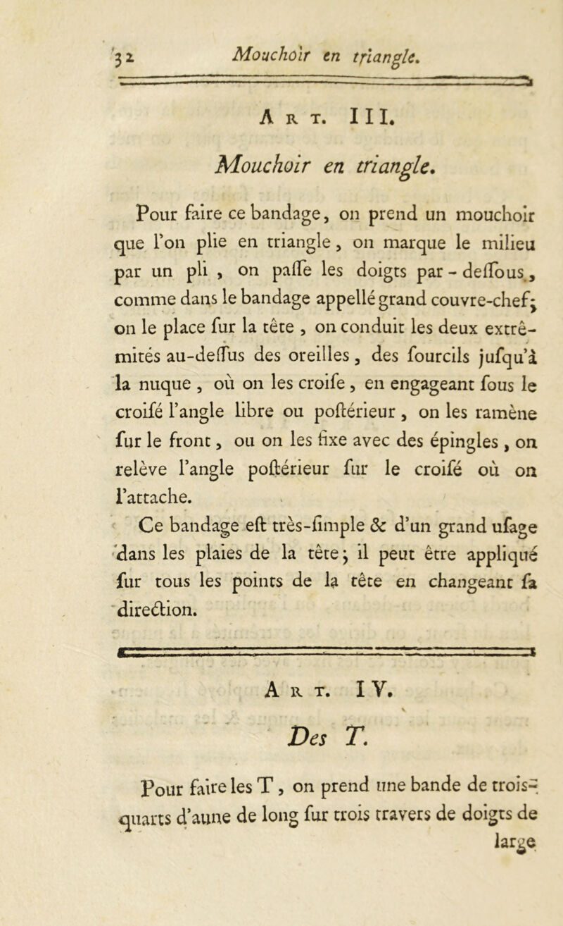 Art. III. Mouchoir en triangle. Pour faire ce bandage, on prend un mouchoir que Ton plie en triangle, on marque le milieu par un pli , on pafie les doigts par-deflous, comme dans le bandage appellé grand couvre-chef: * * on le place fur la tête , on conduit les deux extrê- » mités au-dedus des oreilles, des fourcils jufqu’à la nuque , où on les croife , en engageant fous le croifé l’angle Libre ou poftérieur, on les ramène fur le front, ou on les fixe avec des épingles , on relève l’angle poftérieur fur le croifé où on l’attache. Ce bandage eft très-fimple 8c d’un grand ufage dans les plaies de la tête} il peut être appliqué fur tous les points de la tête en changeant fa direétion. Art. IV. Des T. Pour faite les T, on prend une bande de trois- quarts d’aune de long fur trois travers de doigts de large