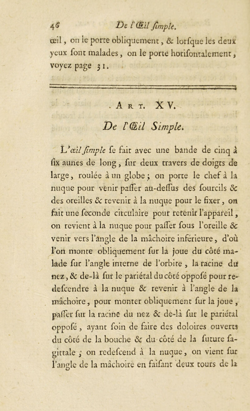 4^ / (Si/ JîmpU, œil, on le porte obliquement, & lorfque les deux yeux font malades, on le porte horifontalement, voyez page 3 1. • • ''r . 1■ ■ ' — ■ ■ ■> .Art. XV. De F (&il Simple* Vœil Jimple fe fait avec une bande de cinq à fix aunes de long, fur deux travers de doigts de large, roulée à un globe 3 on porte le chef à la nuque pour venir palier au-delTus des fourcils de des oreilles 8c revenir à la nuque pour le fixer, on fait une fécondé circulaire pour retenir l’appareil, on revient a la nuque pour palfer fous l’oreille de venir vers l’angle de la mâchoire inférieure, d’où l’on monte obliquement fur la joue du côté ma- lade fur l’angle interne de l’orbite , la racine du nez, & de-là fur le pariétal du côté oppofé pour re- defeendre à la nuque 8c revenir à l’angle de la mâchoire, pour monter obliquement fut la joue , palfer fur la racine du nez 8c de-là fur le pariétal oppofé, ayant foin de faire des doloires ouverts du côté de la bouche 8c du côté de la future fa- gittale ; on redefeend à la nuque, on vient fur l’angle de la mâchoire en faifant deux tours de h