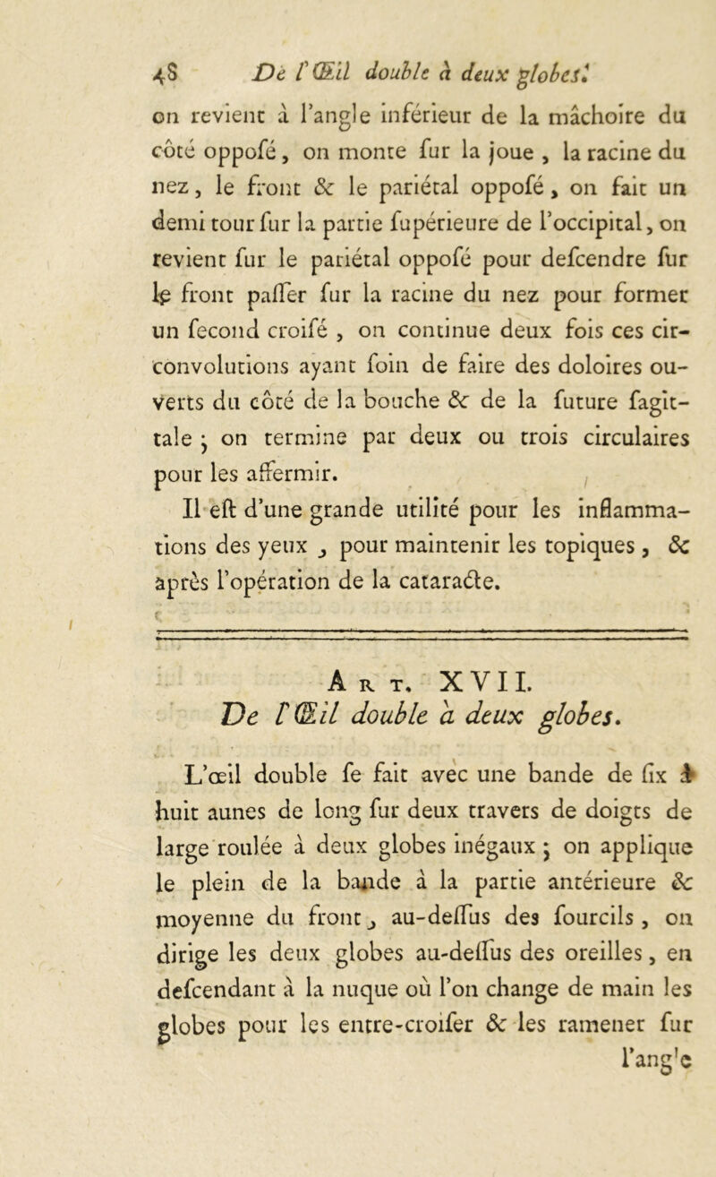 on revient à l’angle inférieur de la mâchoire du côté oppofé, on monte fur la joue , la racine du nez, le front & le pariétal oppofé, on fait un demi tour fur la partie fupérieure de l’occipital, on revient fur le pariétal oppofé pour defeendre fur lp front palfer fur la racine du nez pour former un fécond croifé , on continue deux fois ces cir- convolutions ayant foin de faire des doloires ou- verts du côté de la bouche de de la future fagit- taie j on termine par deux ou trois circulaires pour les affermir. Il eft d’une grande utilité pour les inflamma- tions des yeux pour maintenir les topiques, de après l’opération de la catara&e. Art, XVII. De l'GEil double a deux globes. L’œil double fe fait avec une bande de fix huit aunes de long fur deux travers de doigts de large roulée à deux globes inégaux * on applique le plein de la bande à la partie antérieure de moyenne du front ^ au-dellus des fourcils, on dirige les deux globes au-deflus des oreilles, en defeendant â la nuque où l’on change de main les globes pour les entre-croifer ôc les ramener fur l’ang'c